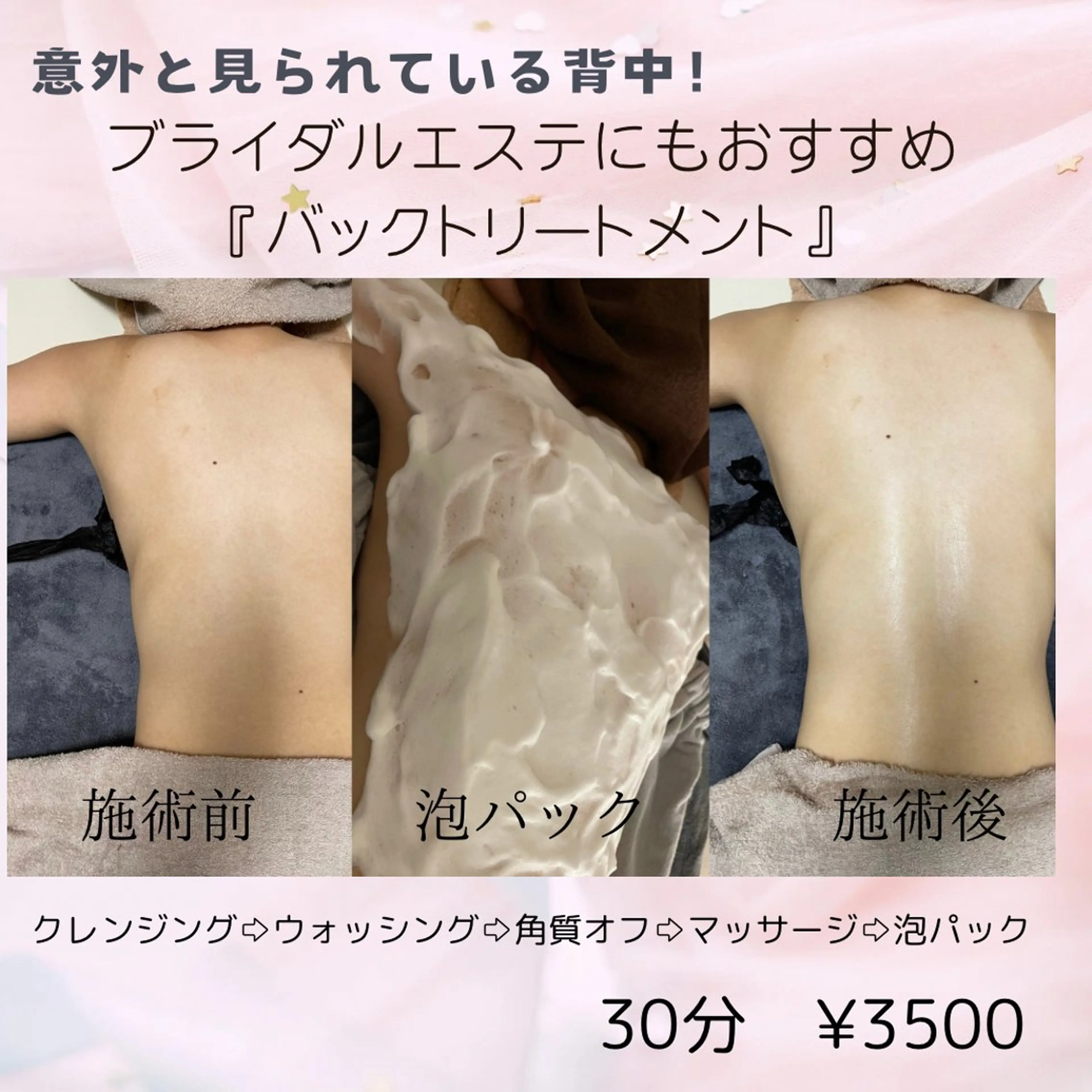 岸和田／久米田 MooMooのエステ・リラクイメージ