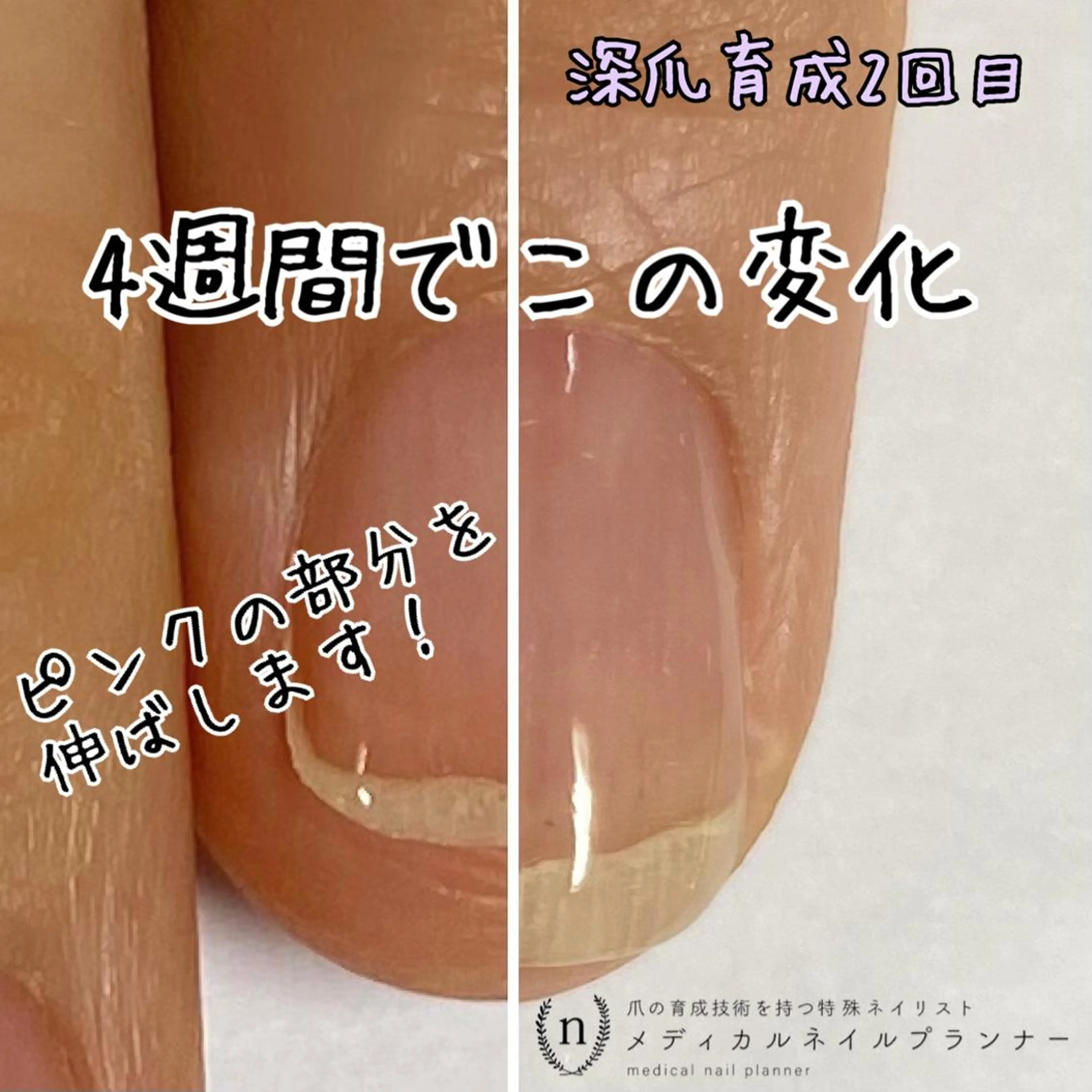 ショート ハンドネイル ハンドケア tsuki elfのエステ・リラクイメージ