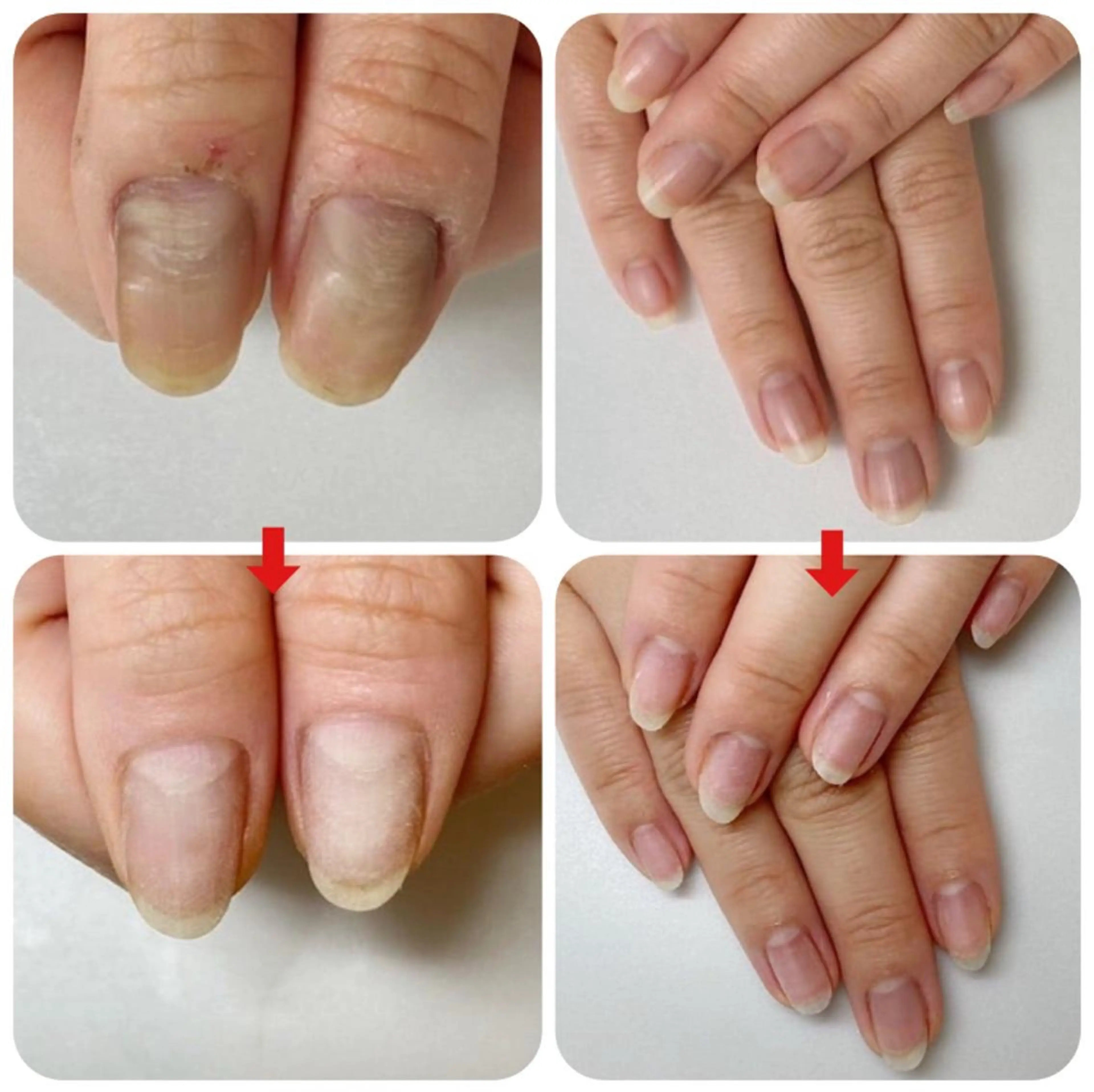 ネイル ネイルサロン アリュームのネイルデザイン