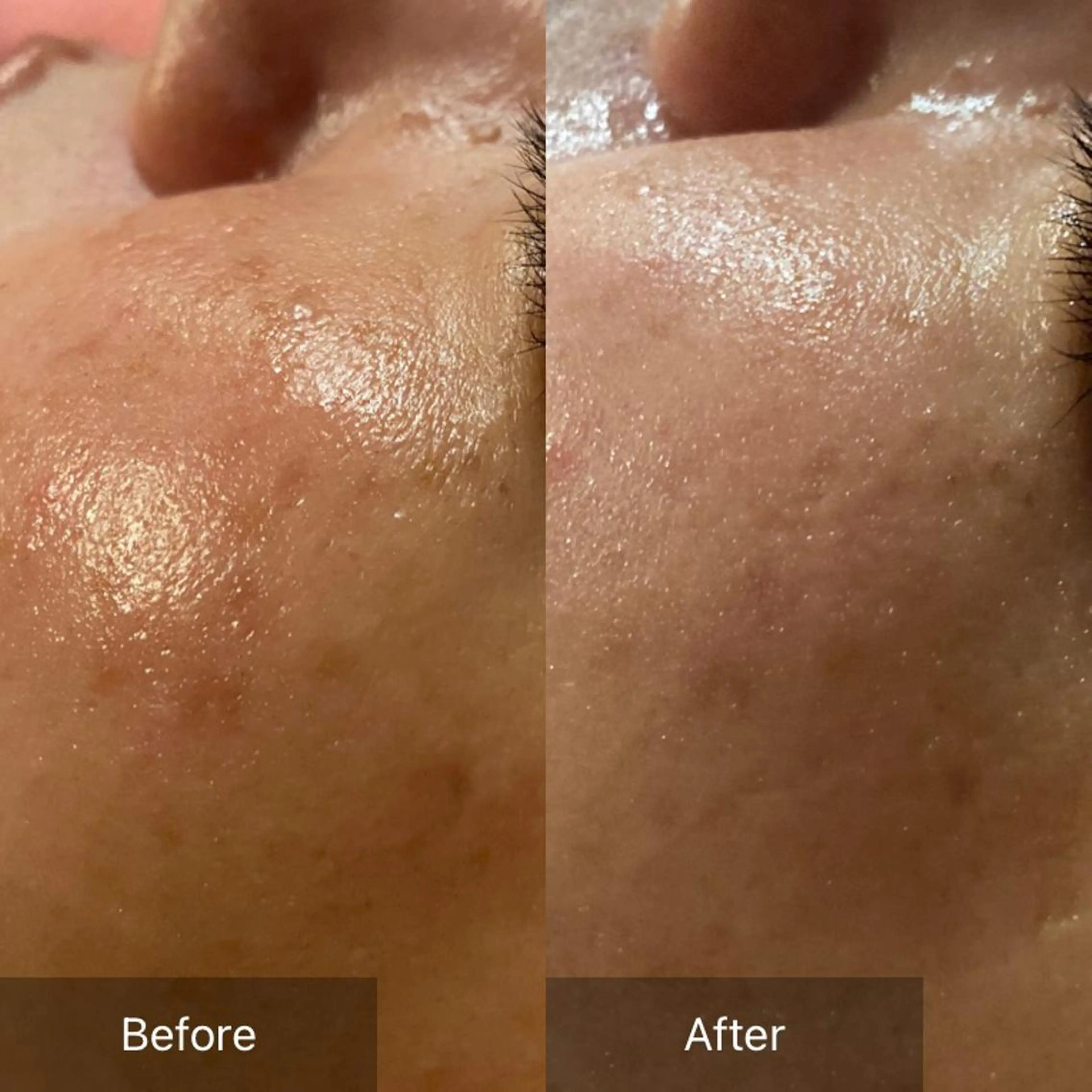 Mandarin Orange所属・毛穴から始める肌メン テマンダリンオレンジのエステ・リラクイメージ