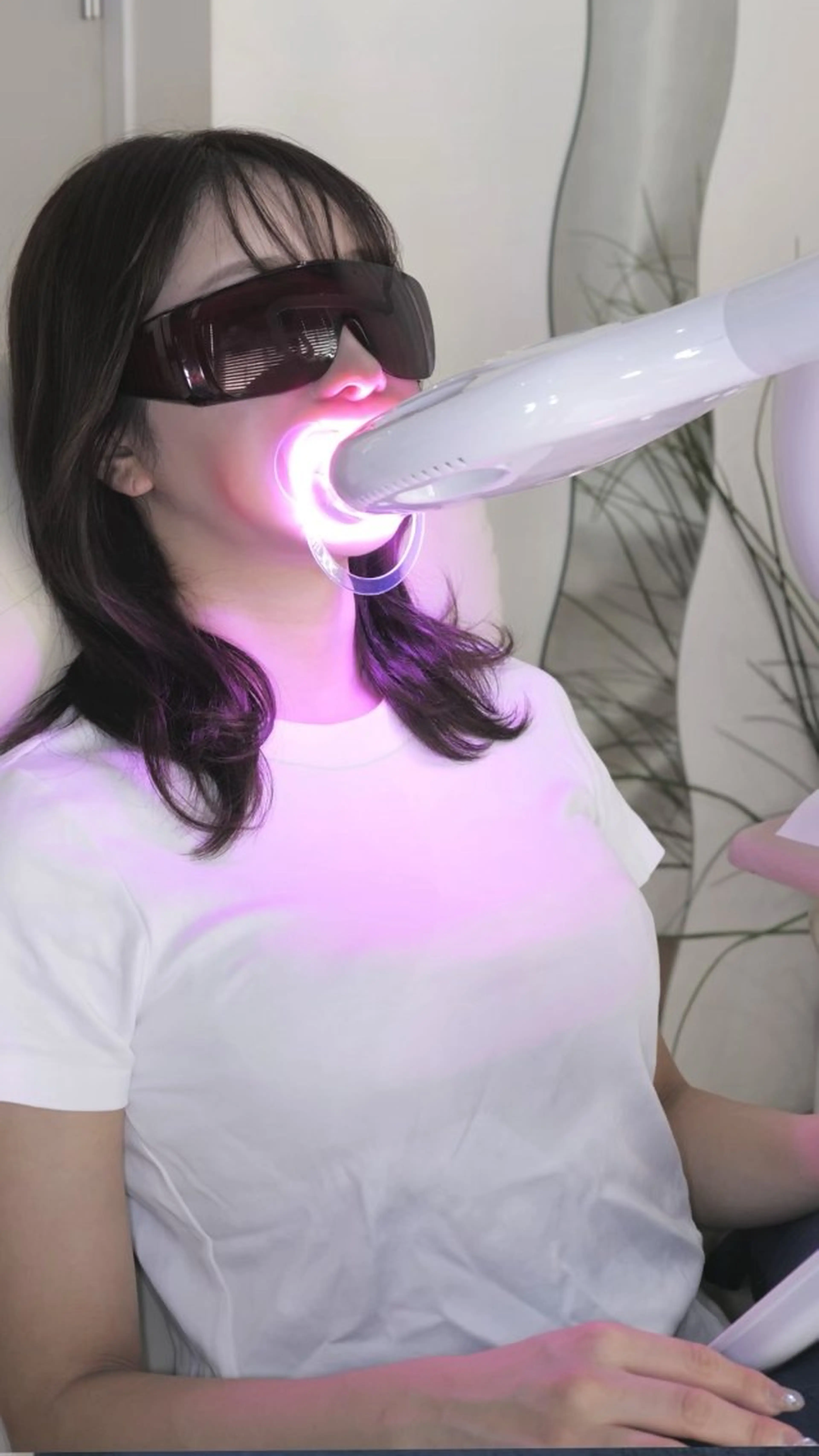 その他 セルフホワイトニング 都立大学🦷✴︎のその他イメージ