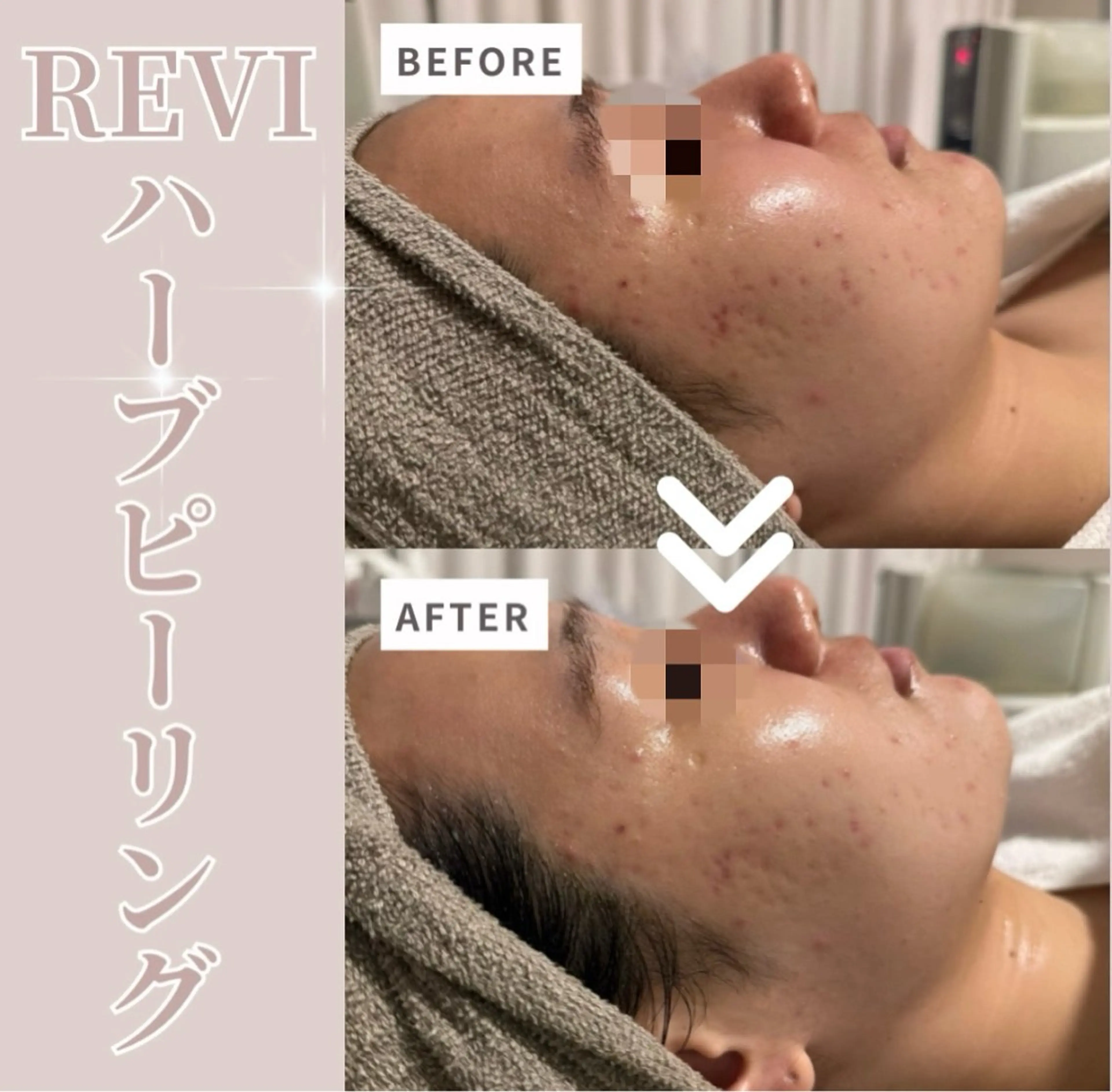 lumi riseのエステ・リラクイメージ