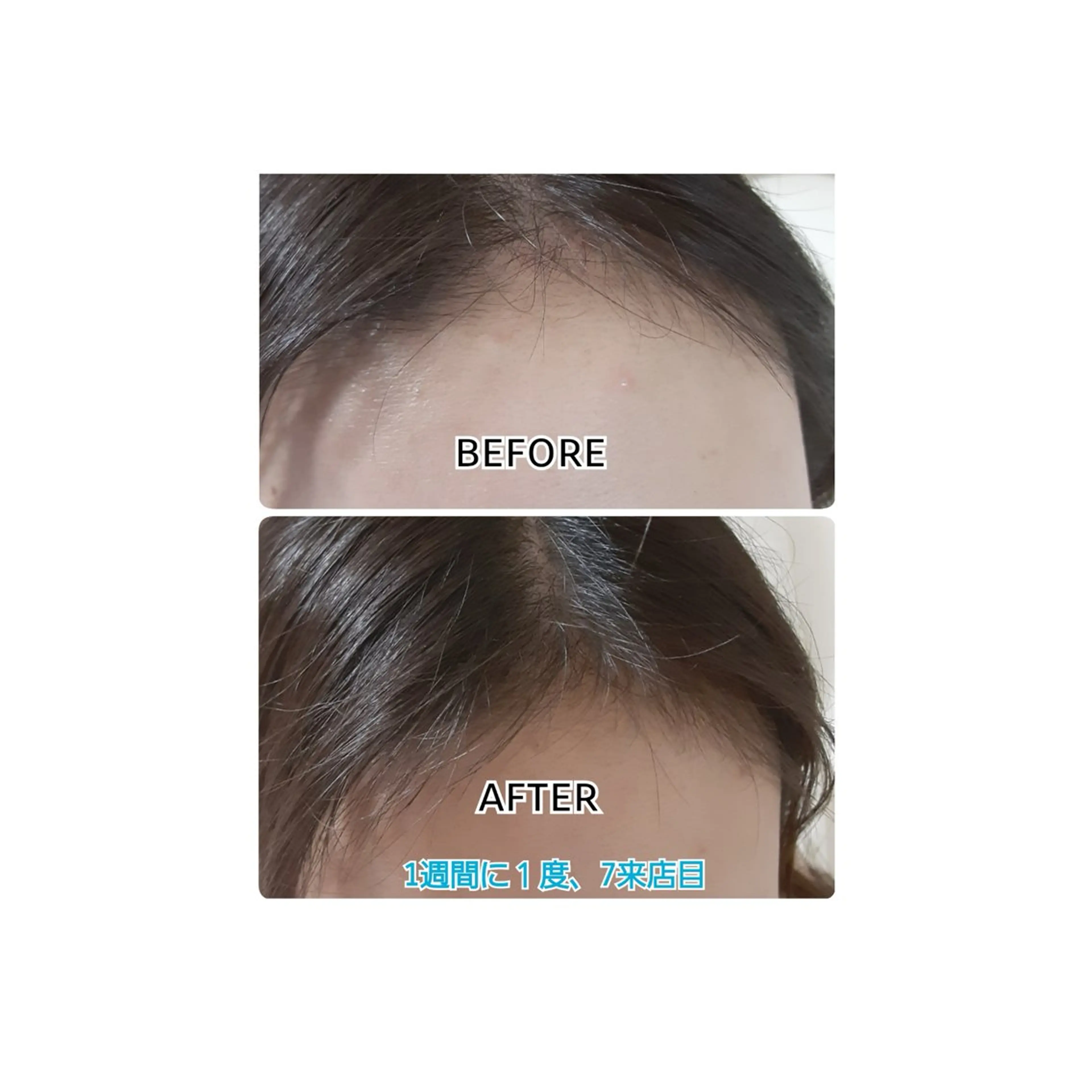 ヘッドスパ 五十嵐 蓮のその他イメージ