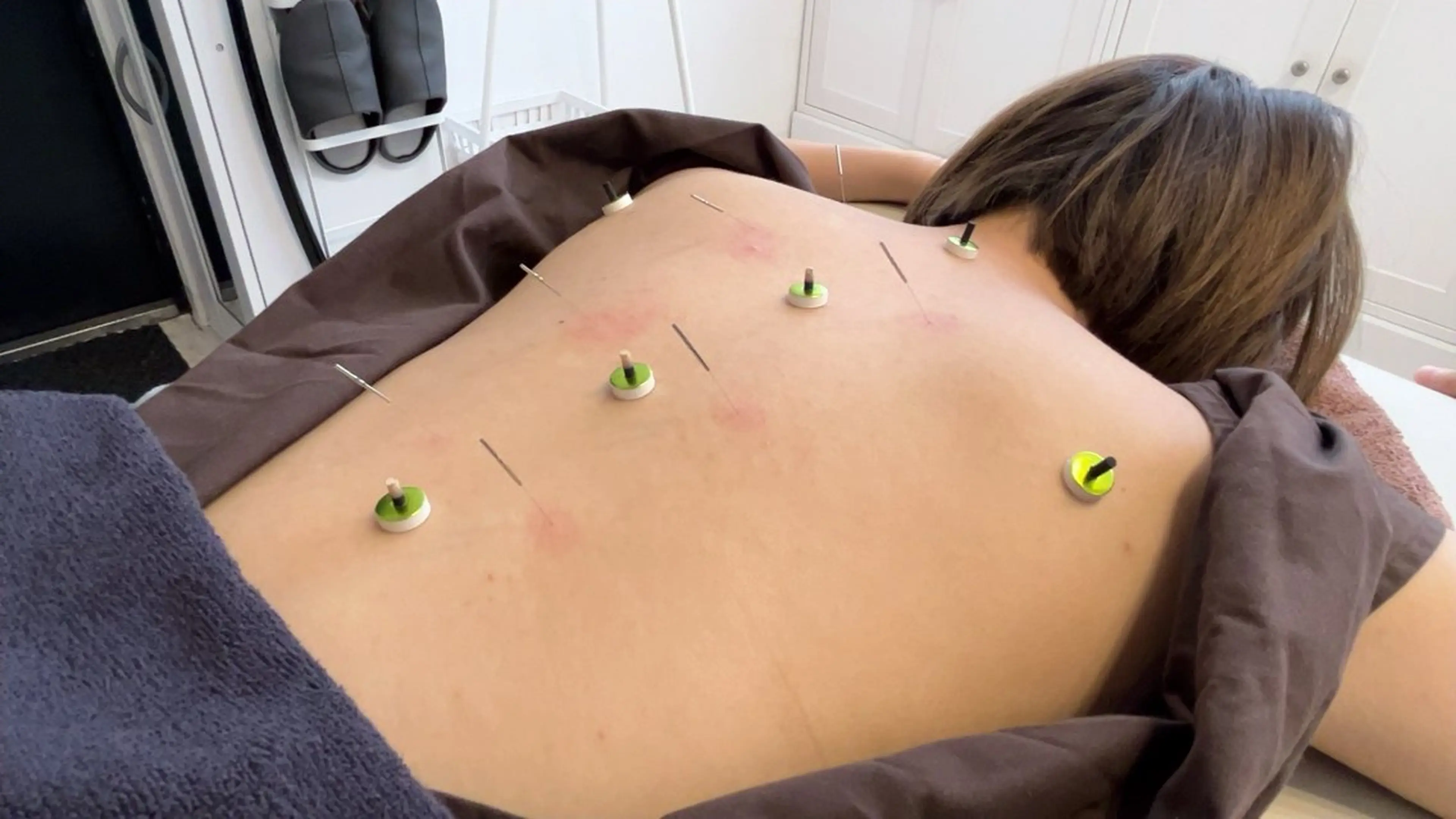 オーダーメイド鍼灸施術＋ボディケア90分の写真