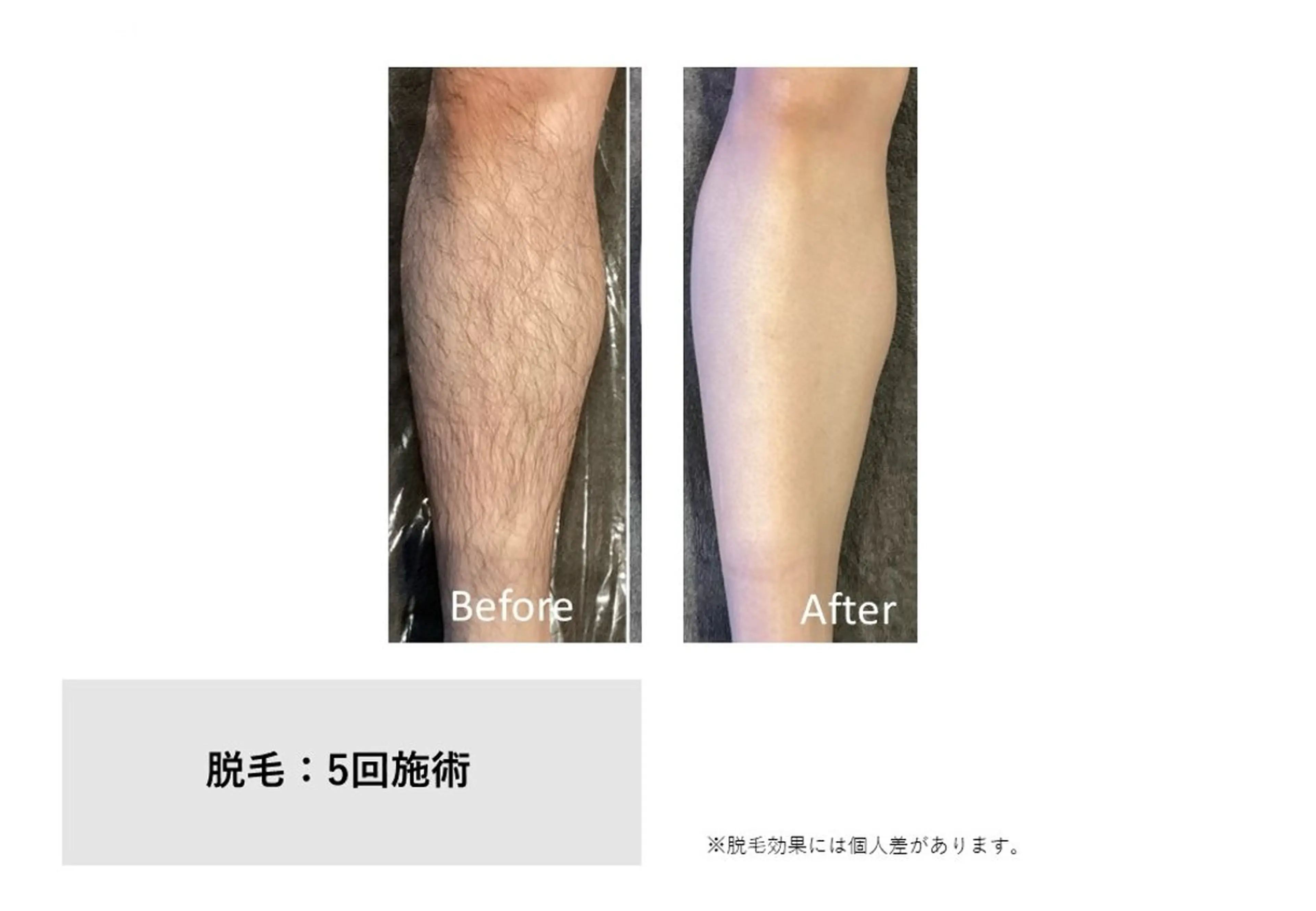 脱毛 RIKKA☆脱毛/ アイブロウ/メイクの眉毛・アイブロウイメージ