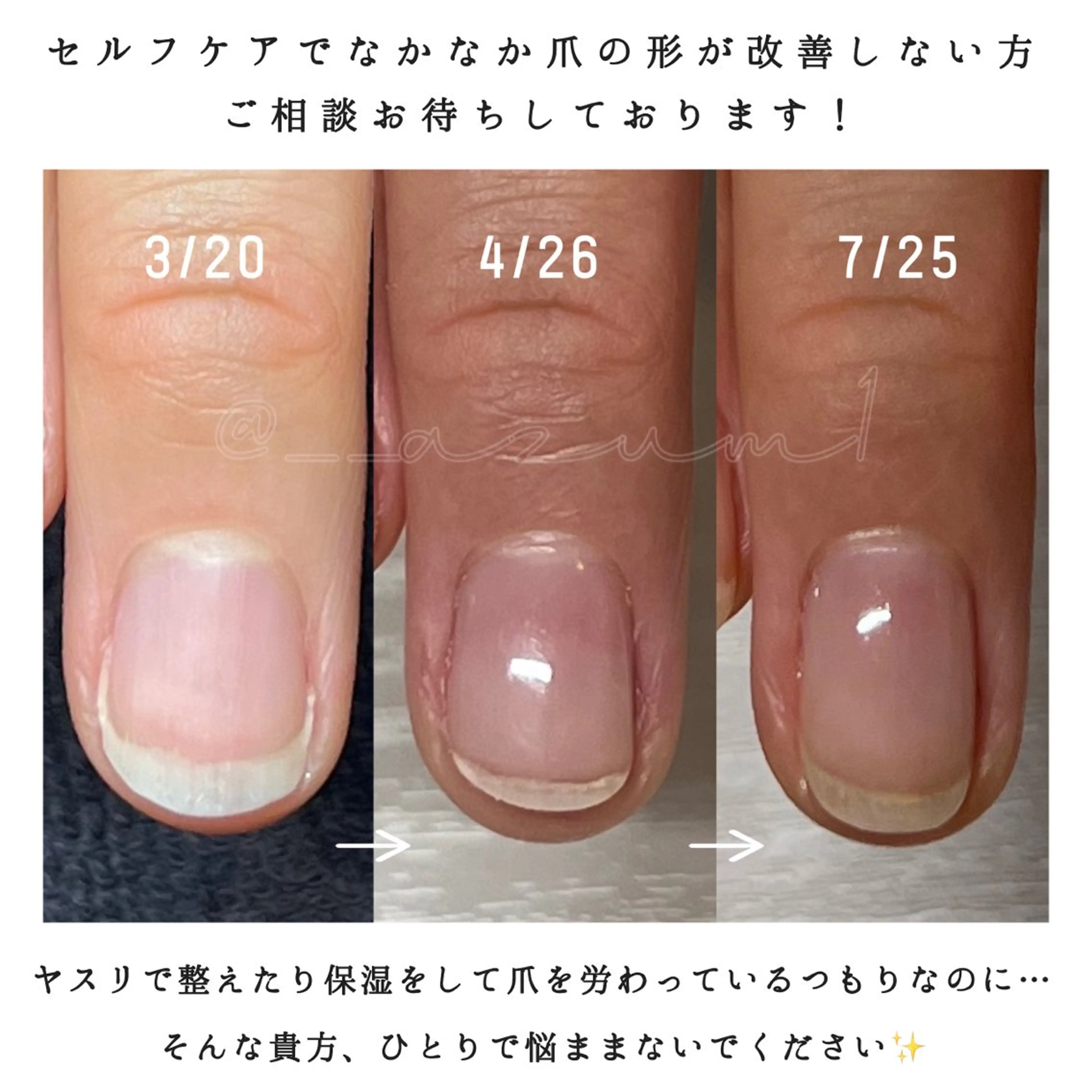 ネイル ハンドネイル 自爪育成専門サロン ◌𓈒azumiのネイルデザイン