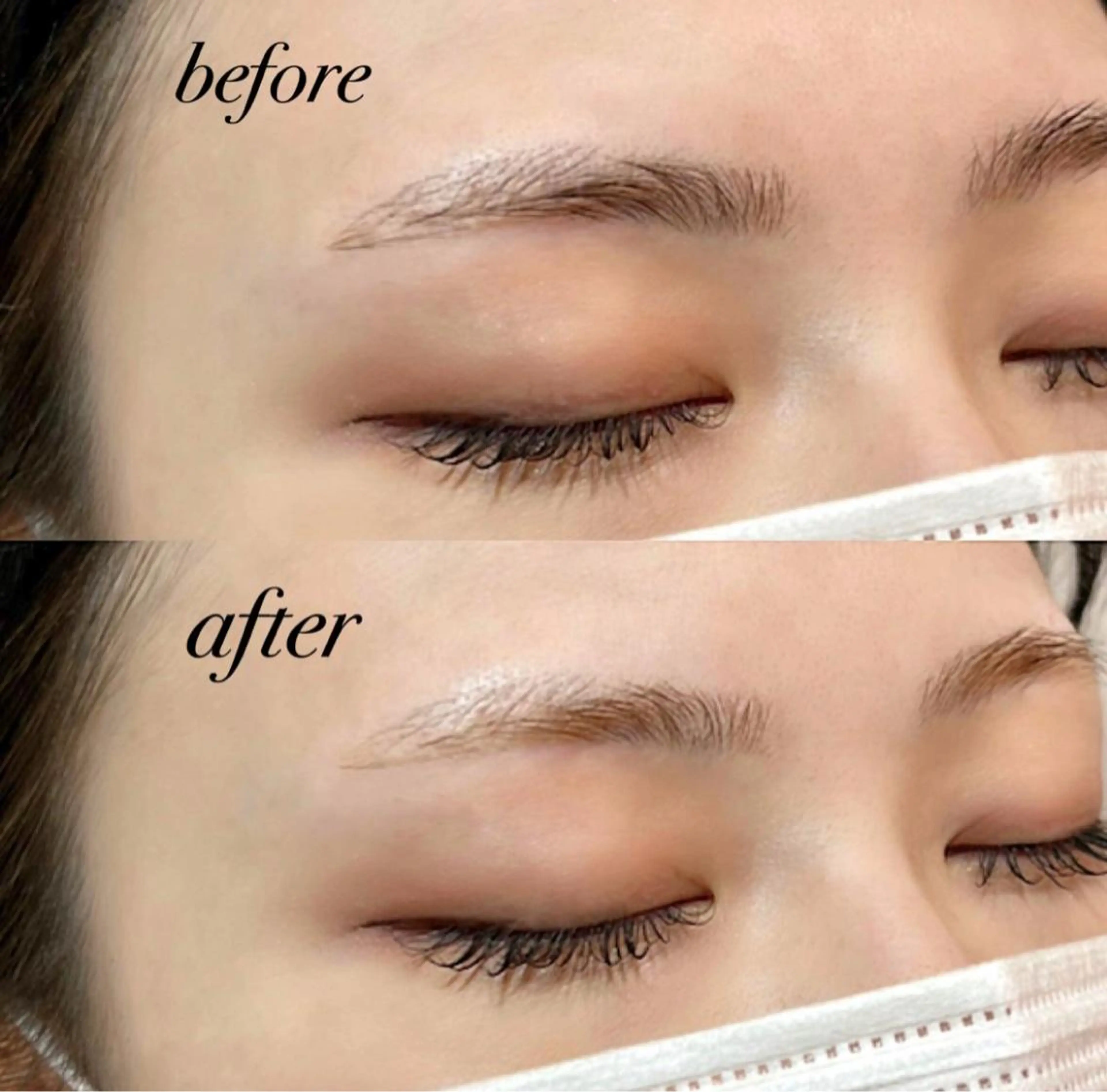 ã¢ã€ãã㊠ð¢ ð ð€ ð©¶ã®ãããšã¯ã»ããããã¶ã€ã³