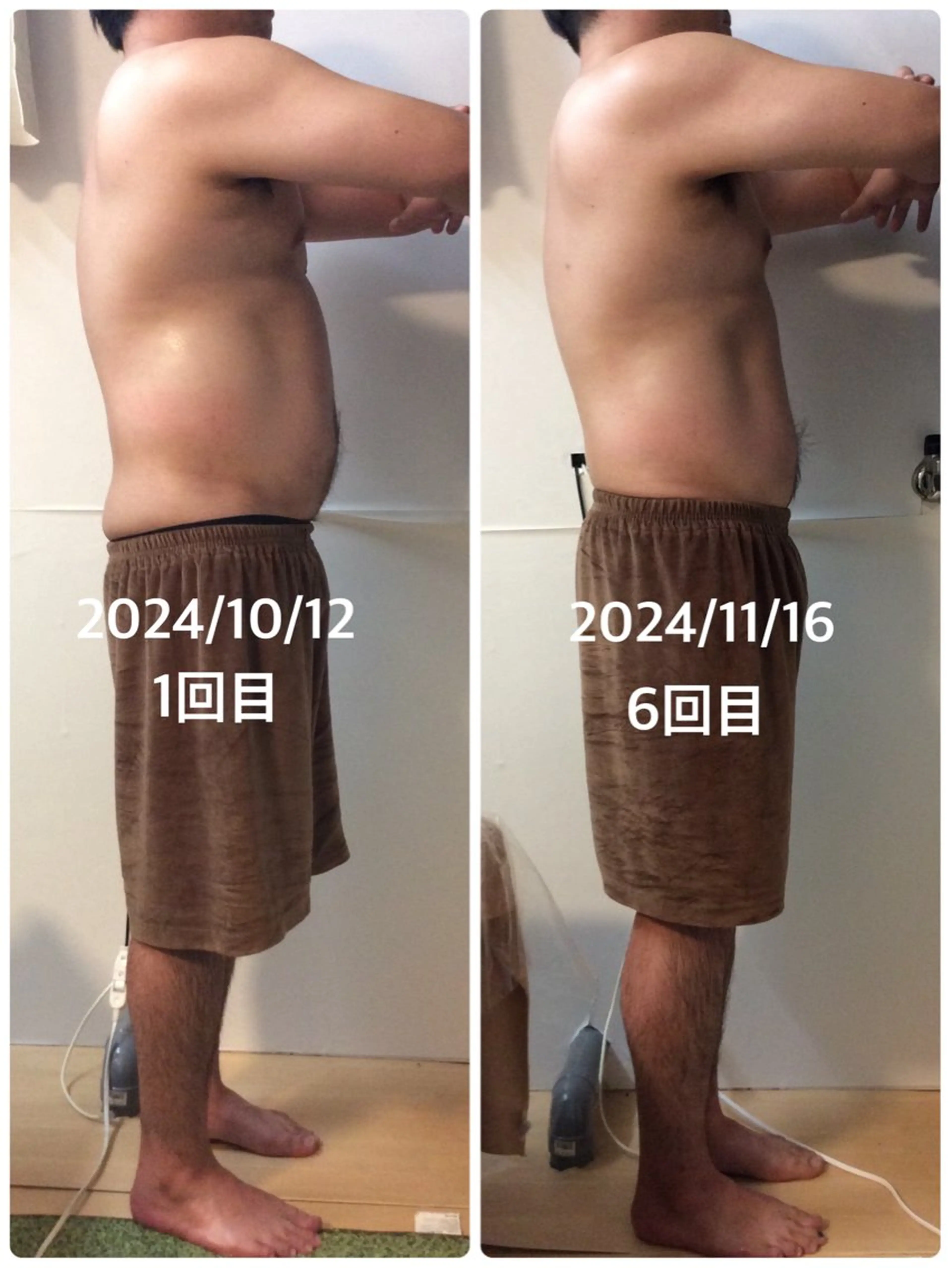 【men'sもOK】オールハンド痩身　全身150分の写真