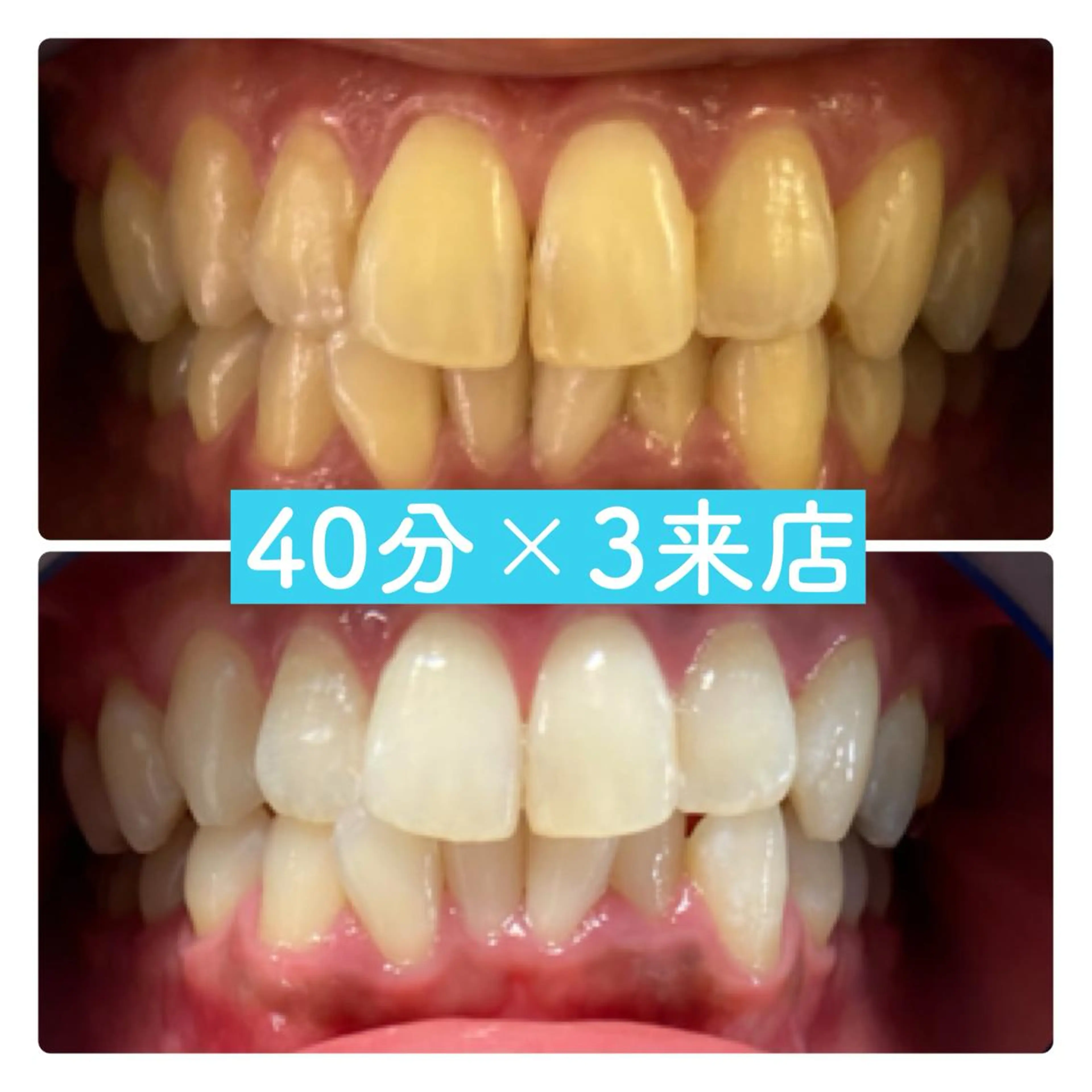 ホワイトニングルーム 横浜店のその他イメージ