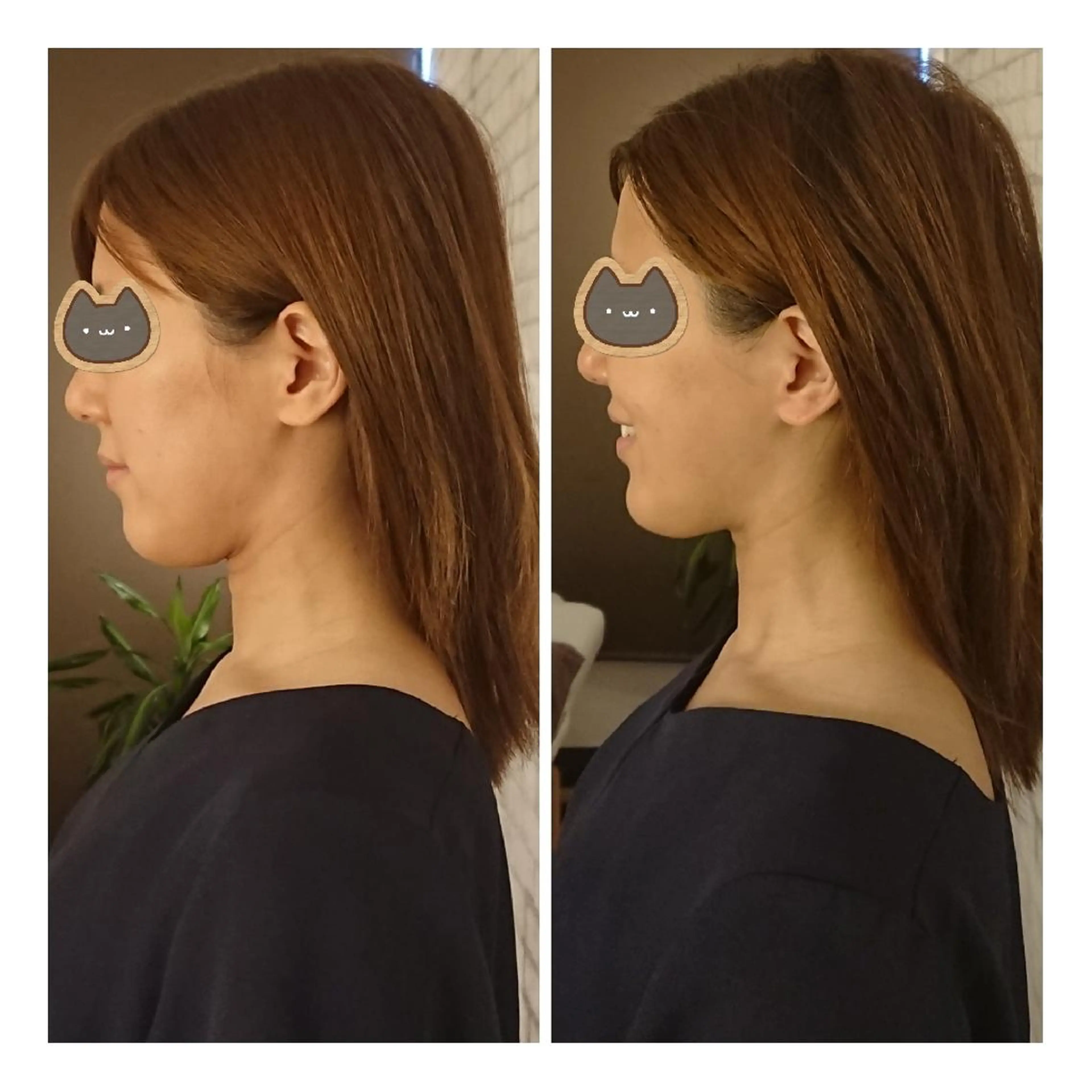 エステ リラク 美容矯正 ＱＵＩＣＯ【キコ】のエステ・リラクイメージ