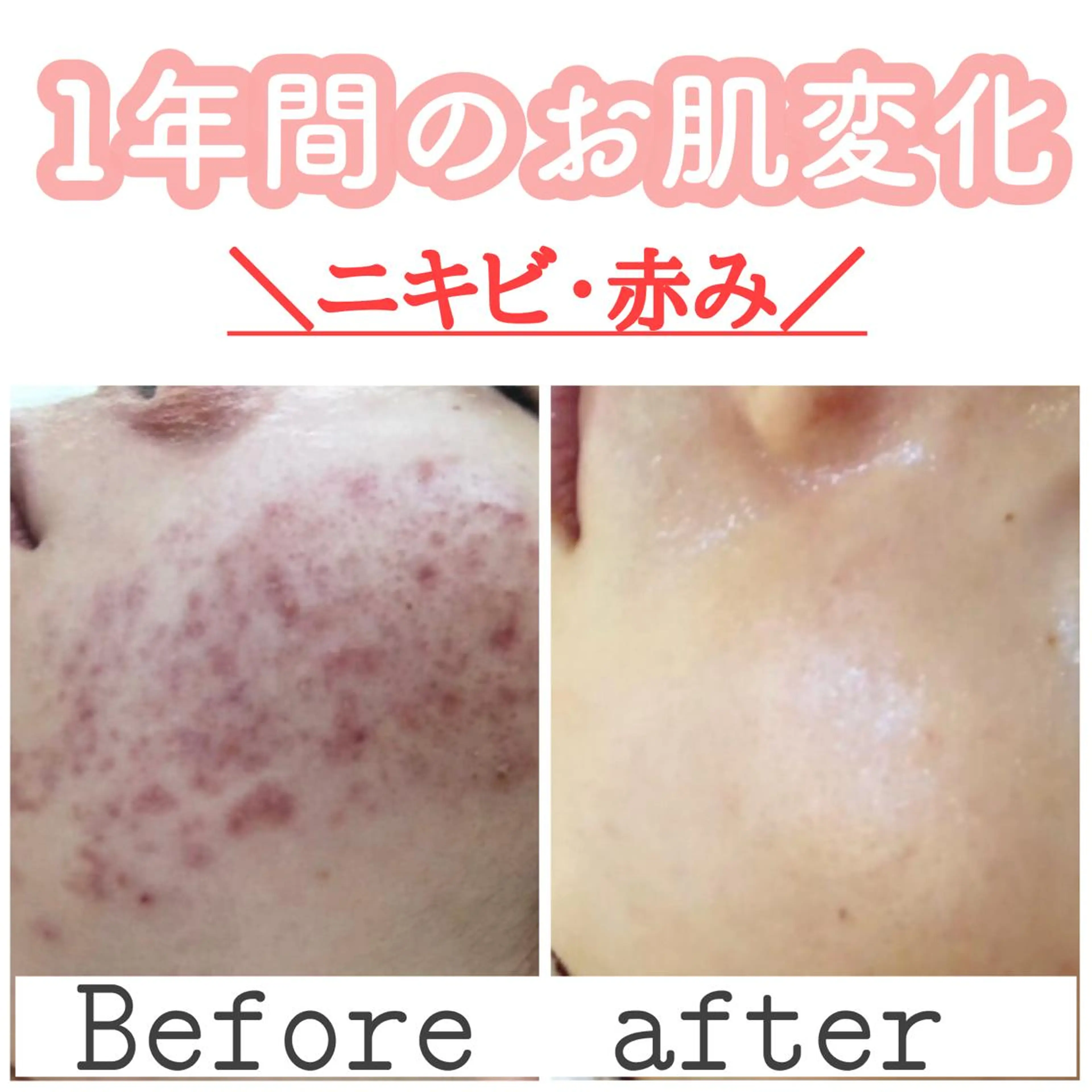 ショート カラー パーマ ヘアアレンジ メンズ キッズ ネイル マツエク・マツパ ニキビ&跡改善サロン オーナー光木のエステ・リラクイメージ