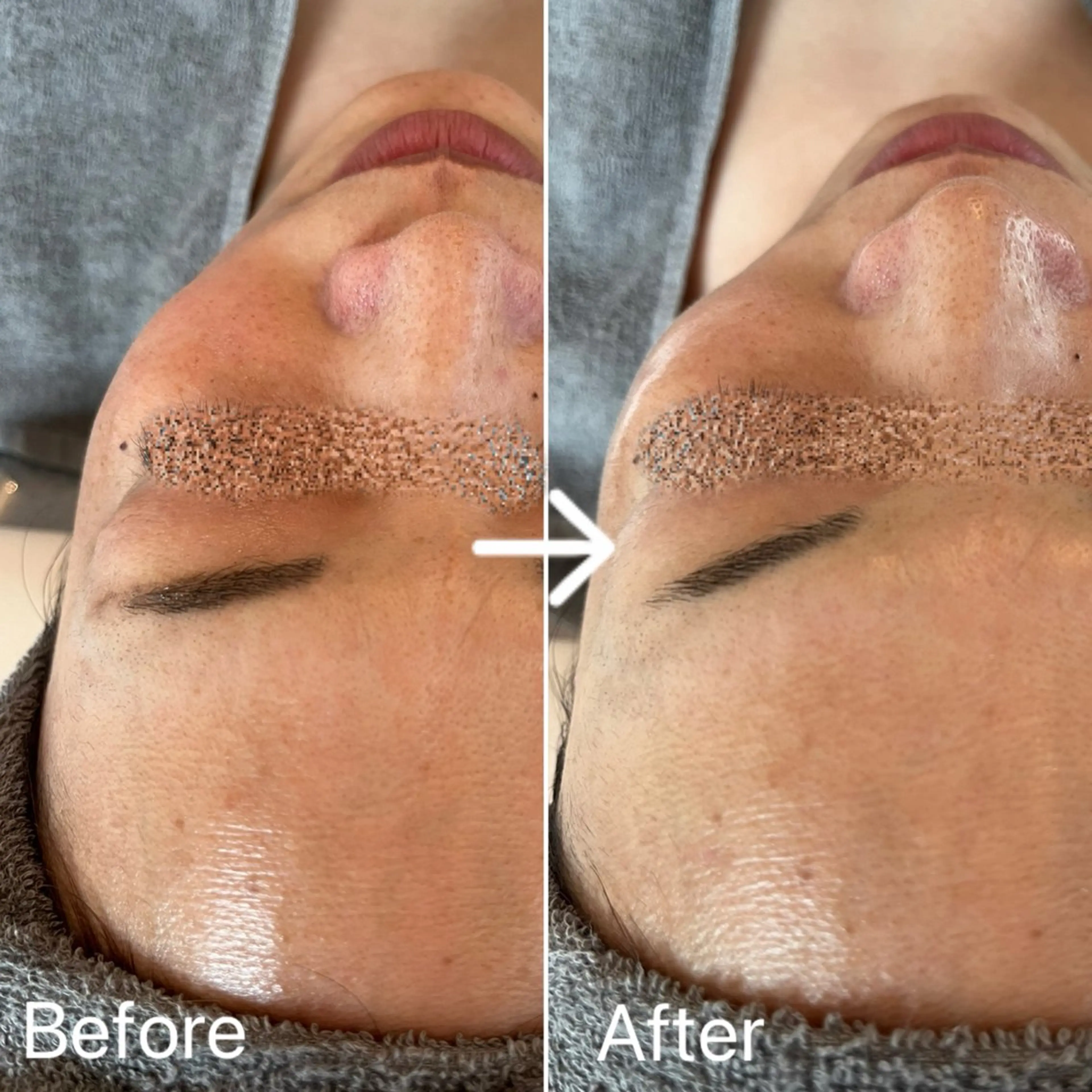 Blue Moon 【ブルームーン】のエステ・リラクイメージ