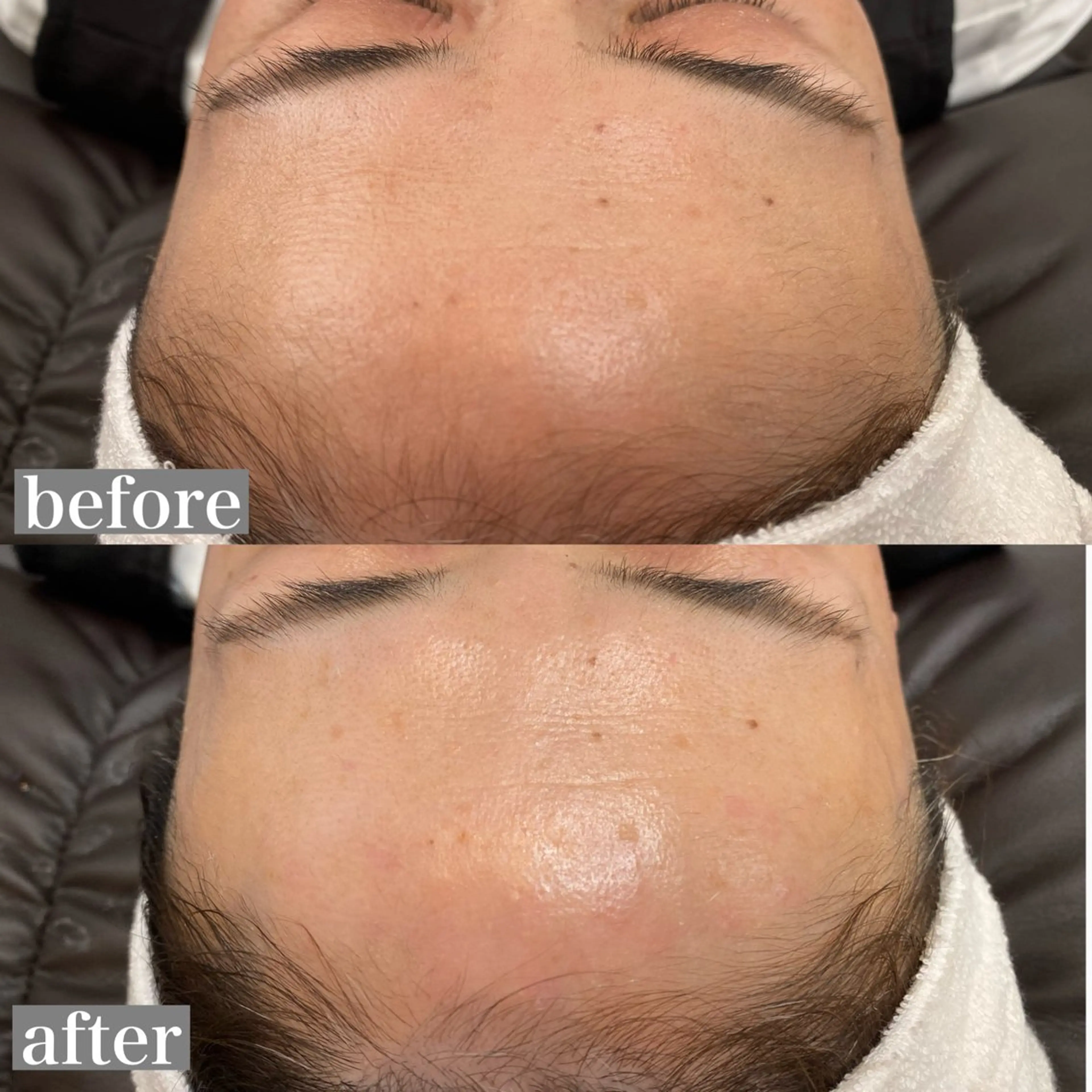 Red Moat所属・Red Moatのマツエク・マツパデザイン