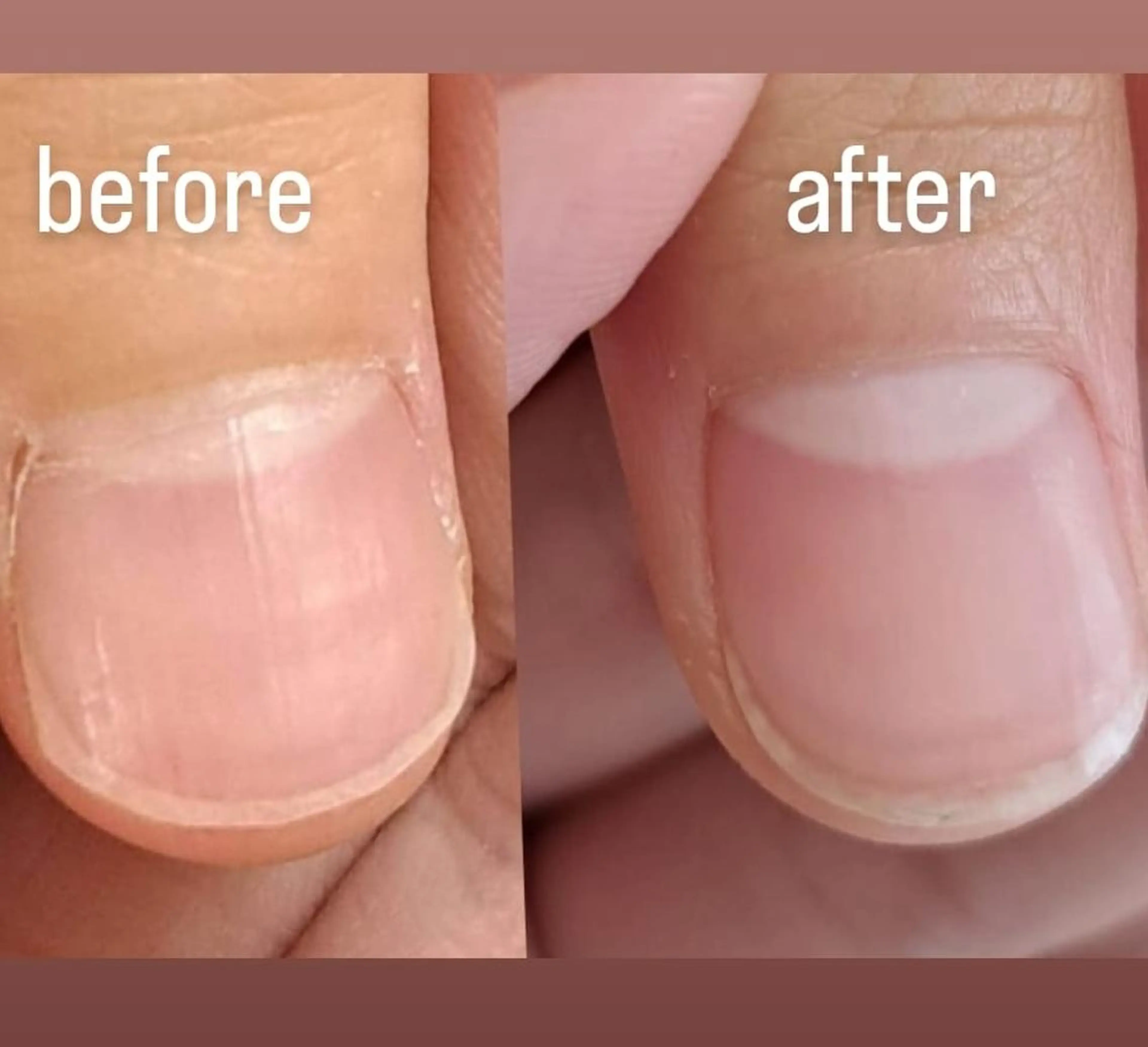 ネイルケアの写真