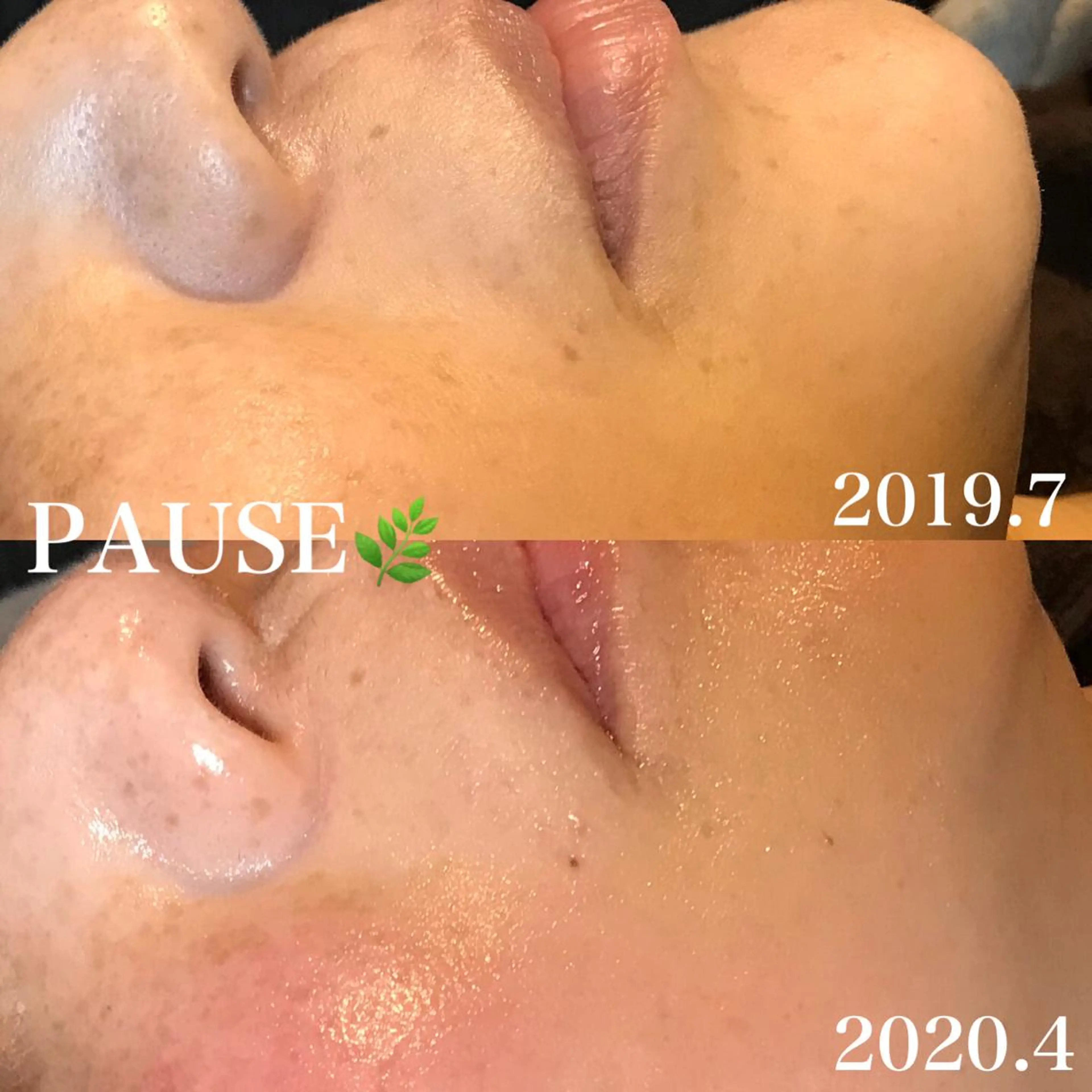 エステ 浜野 恵美のエステ・リラクイメージ