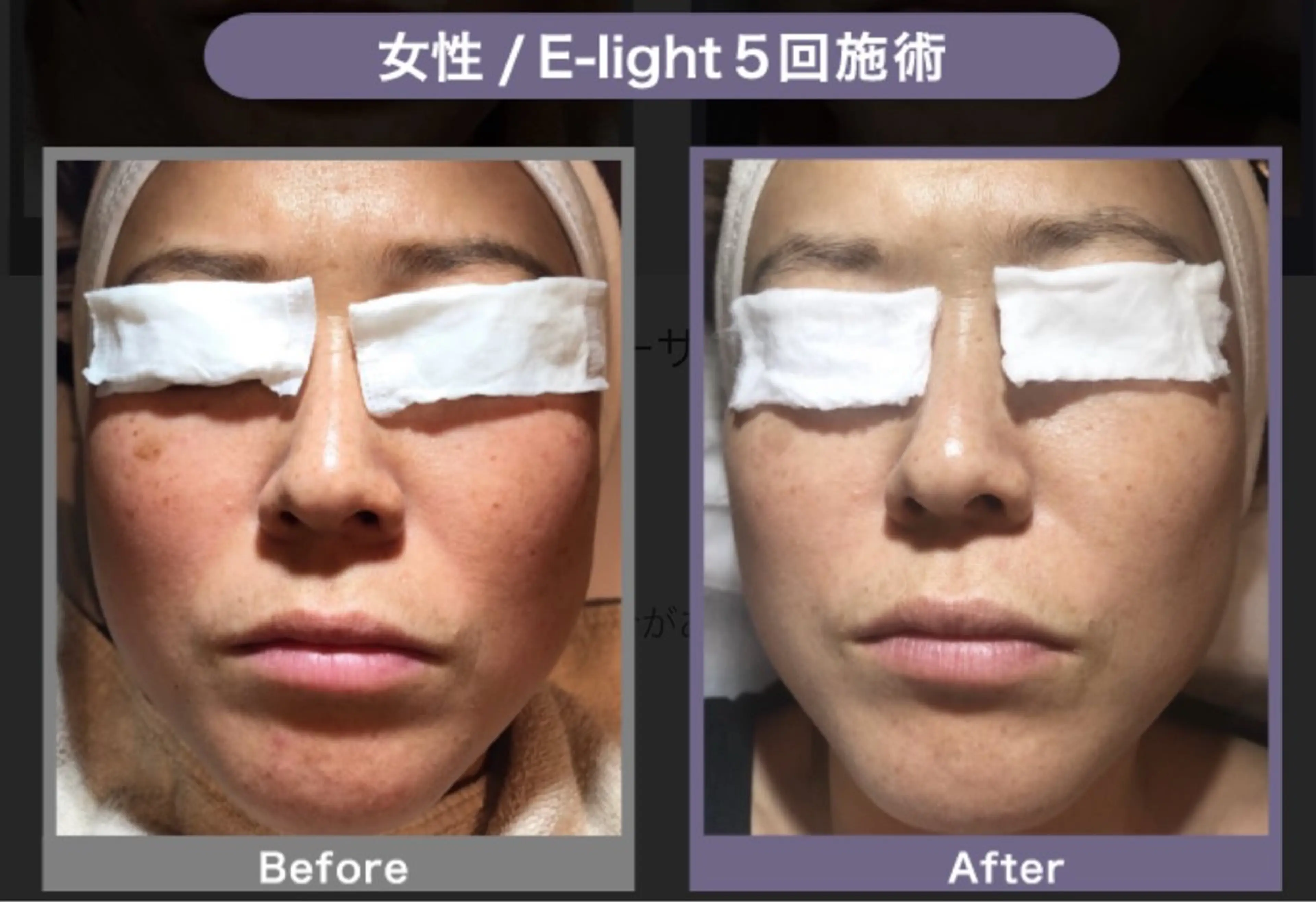 エステ 🤍SÉALIE⟡. ｼｱﾘｰ脱毛サロンのエステ・リラクイメージ