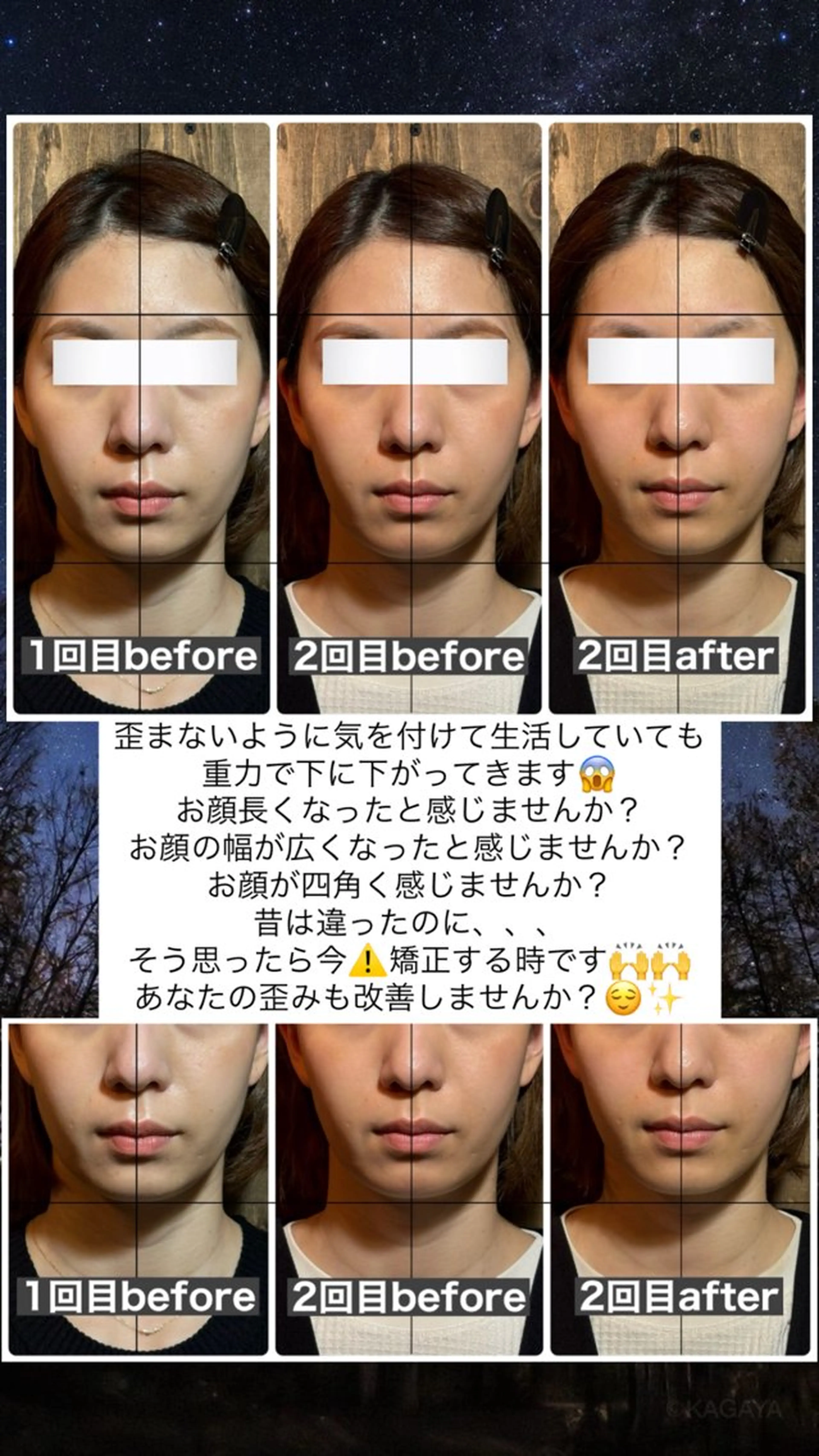 エステ リラク 💎後悔させない小顔 矯正💎イトヤマ🌱のエステ・リラクイメージ