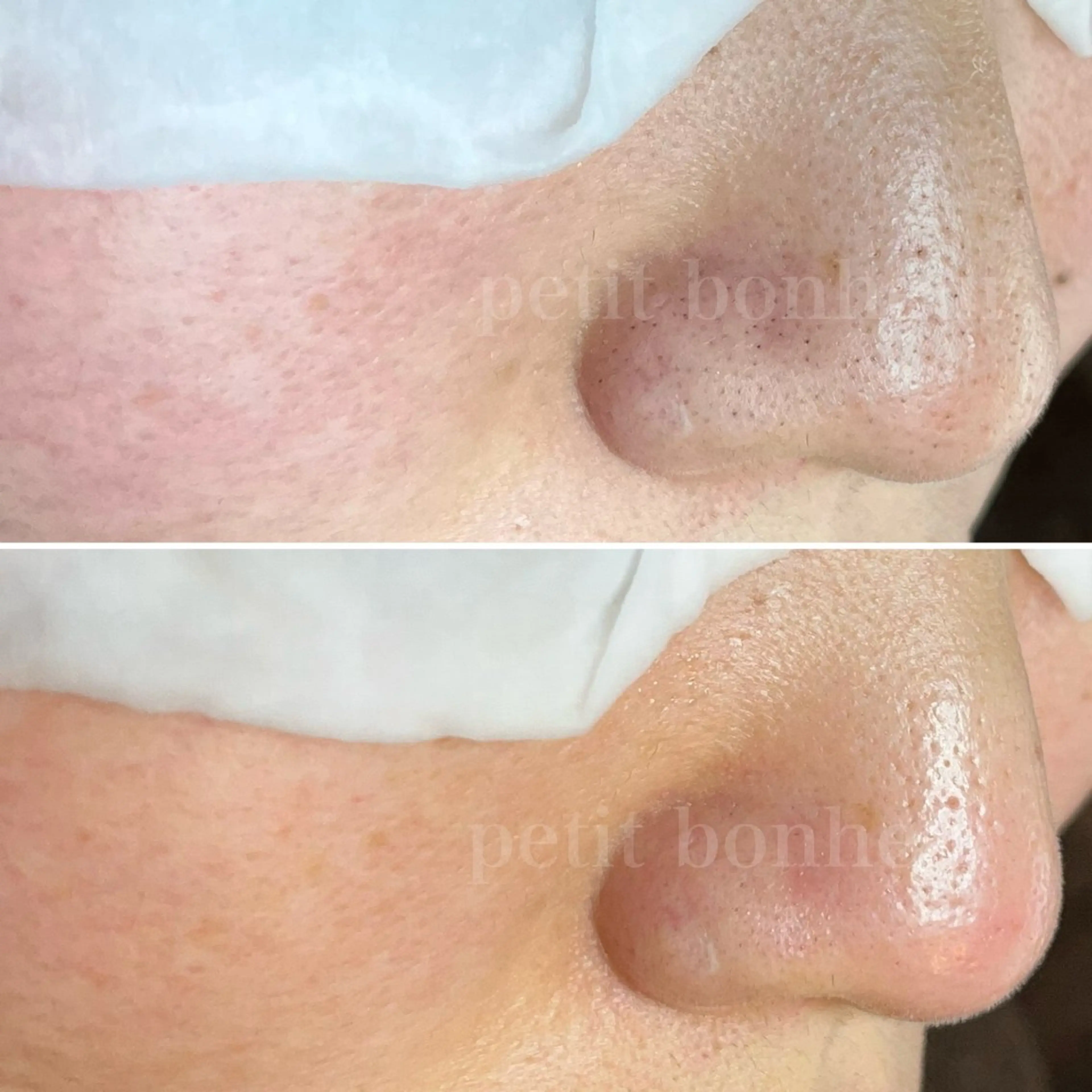 エステ 槙谷 あさみのエステ・リラクイメージ