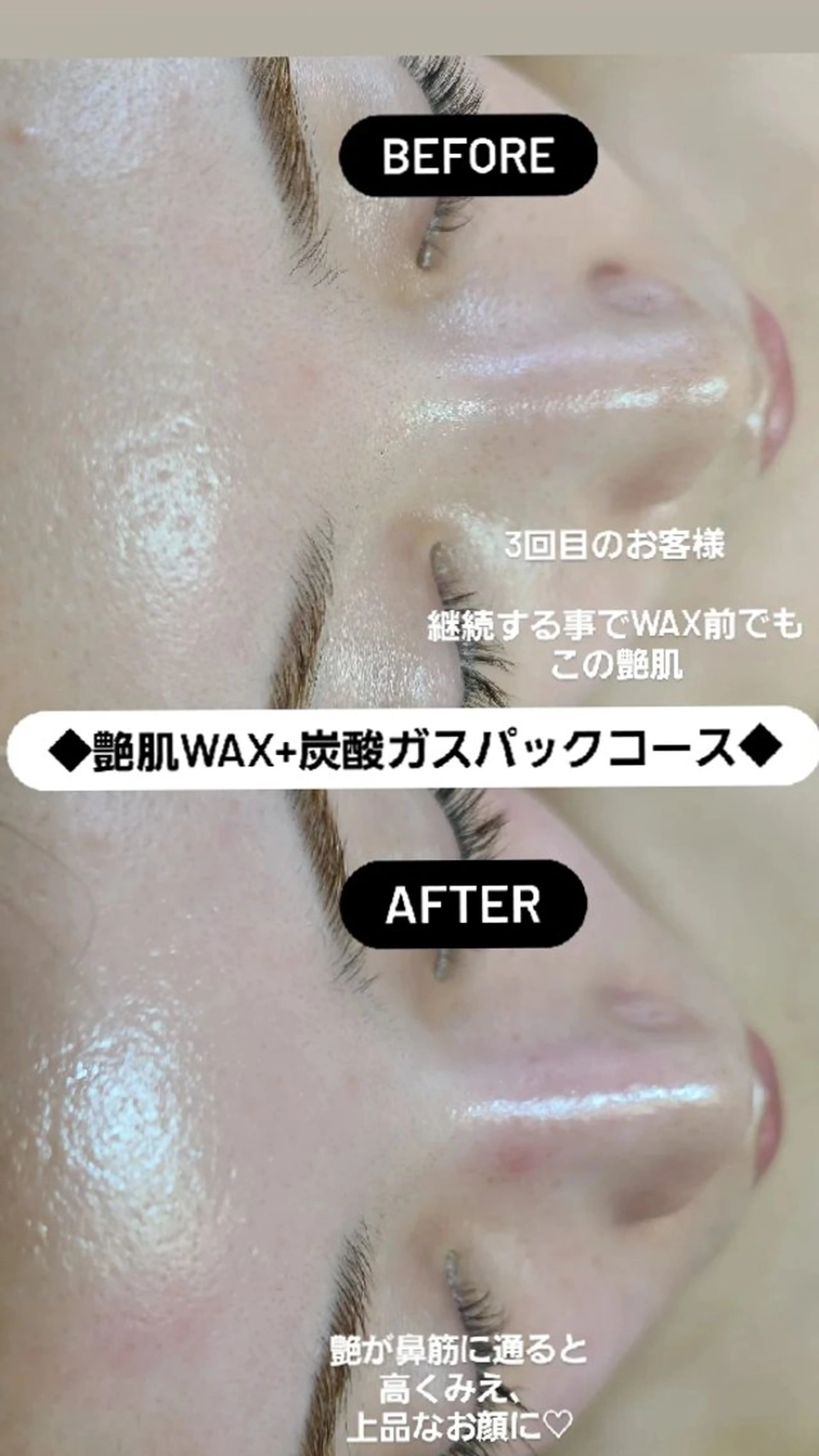 艶肌Wax新宿３丁目 &巻き爪矯正のエステ・リラクイメージ