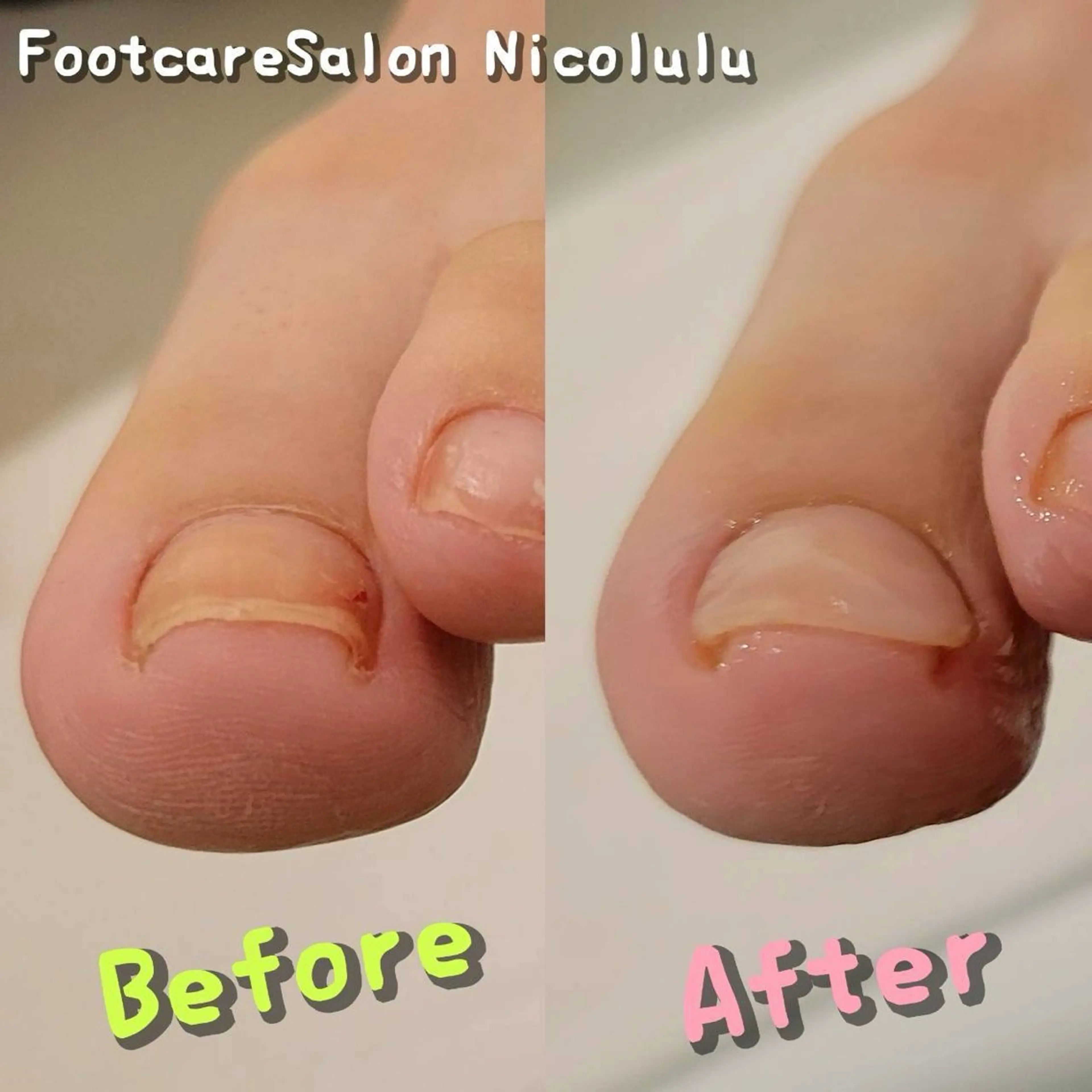 リラク 足トラブル専門 ニコルル金沢のエステ・リラクイメージ