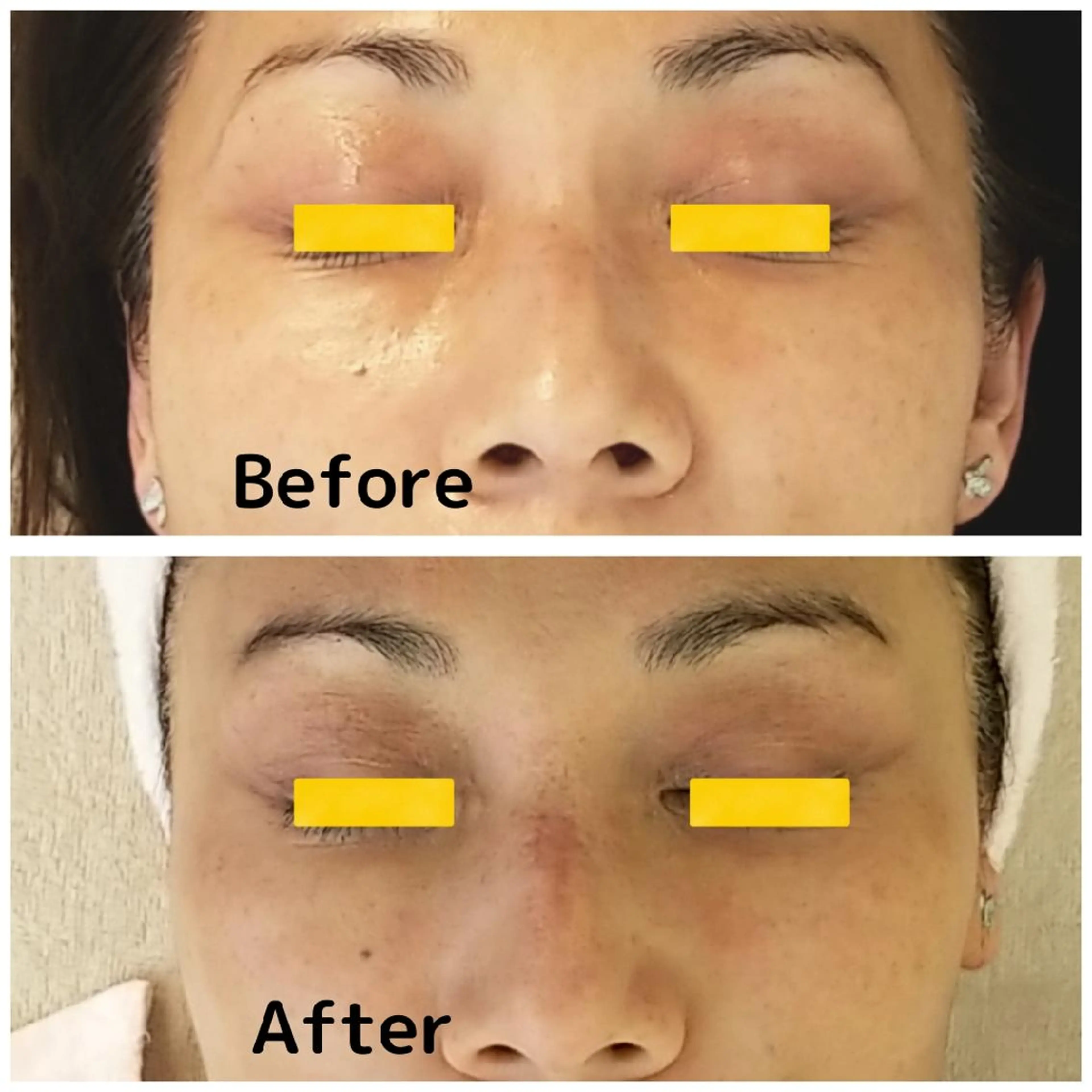 自然派フェイシャル やながわのエステ・リラクイメージ