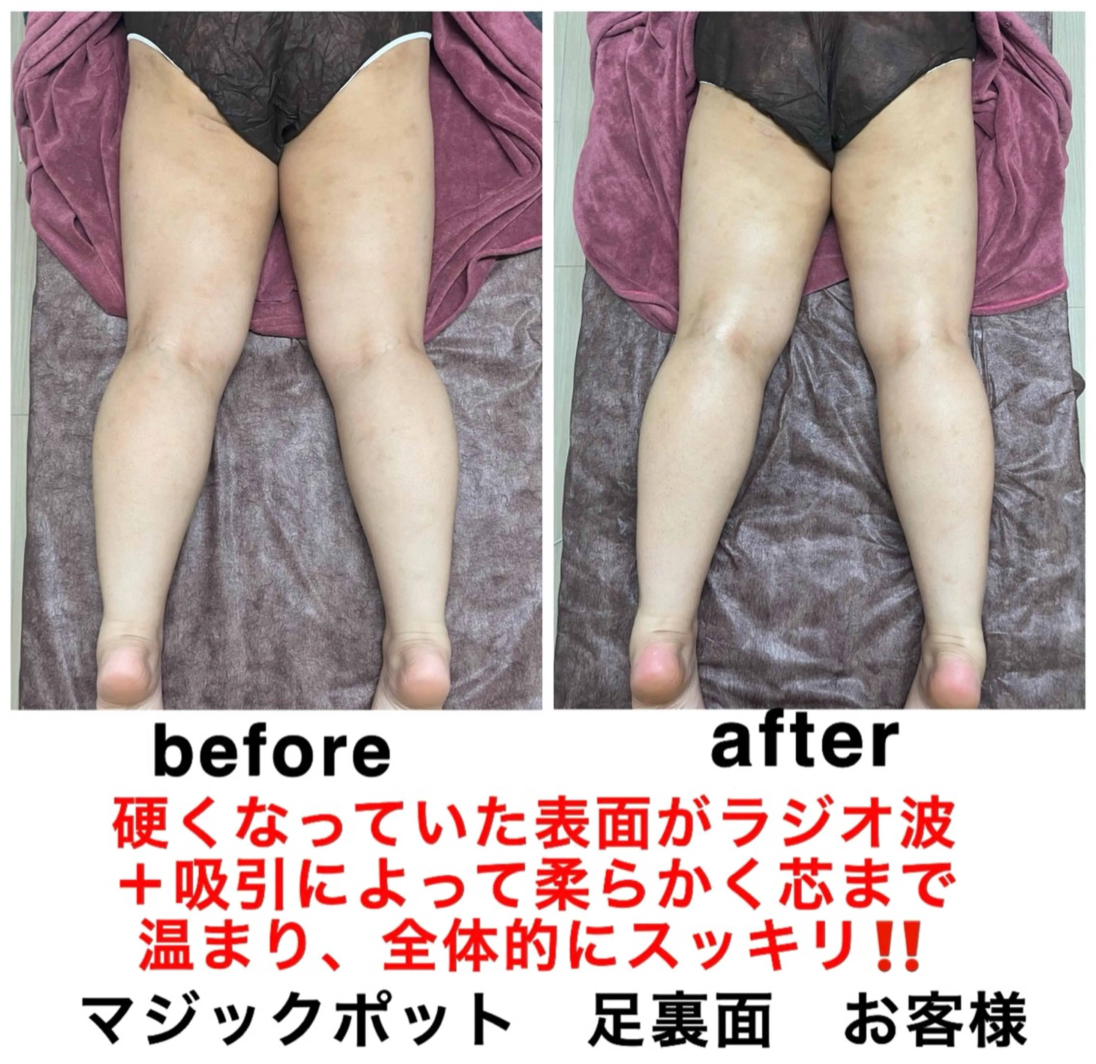 エステ リラク ネイル・エステサロン UILANIのネイルデザイン