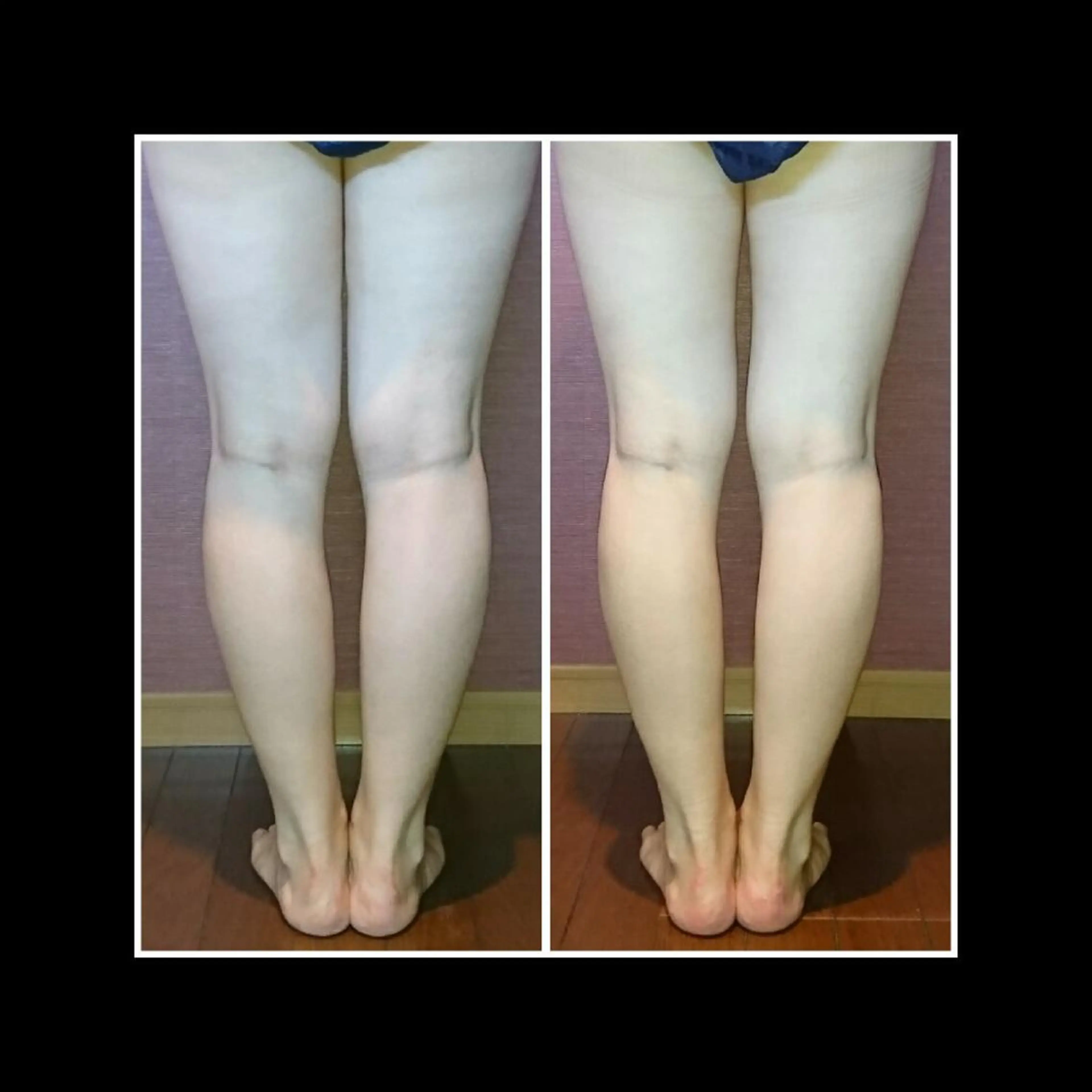 エステ リラク Nako  ﾅｺのエステ・リラクイメージ