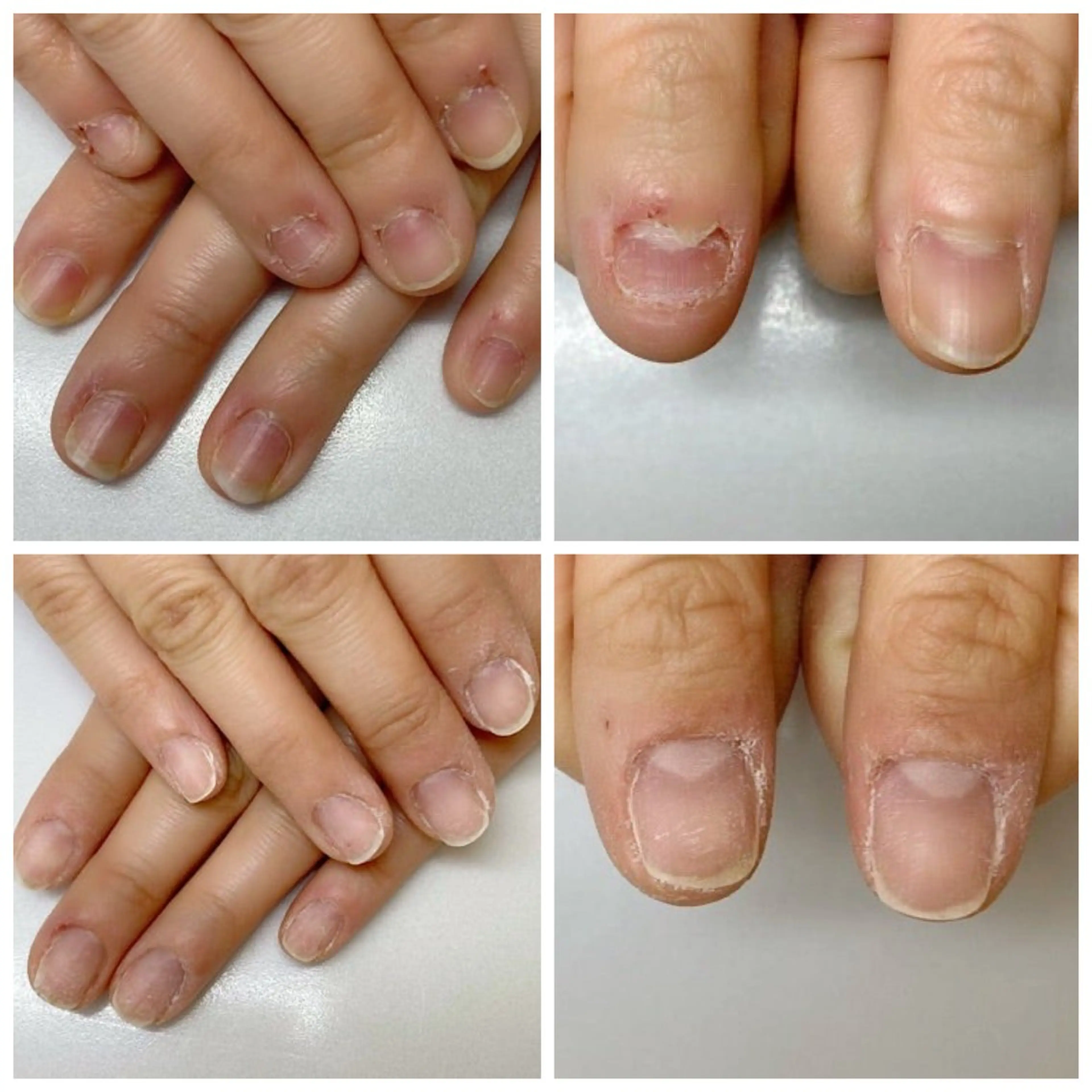 ネイル ネイルサロン アリュームのネイルデザイン