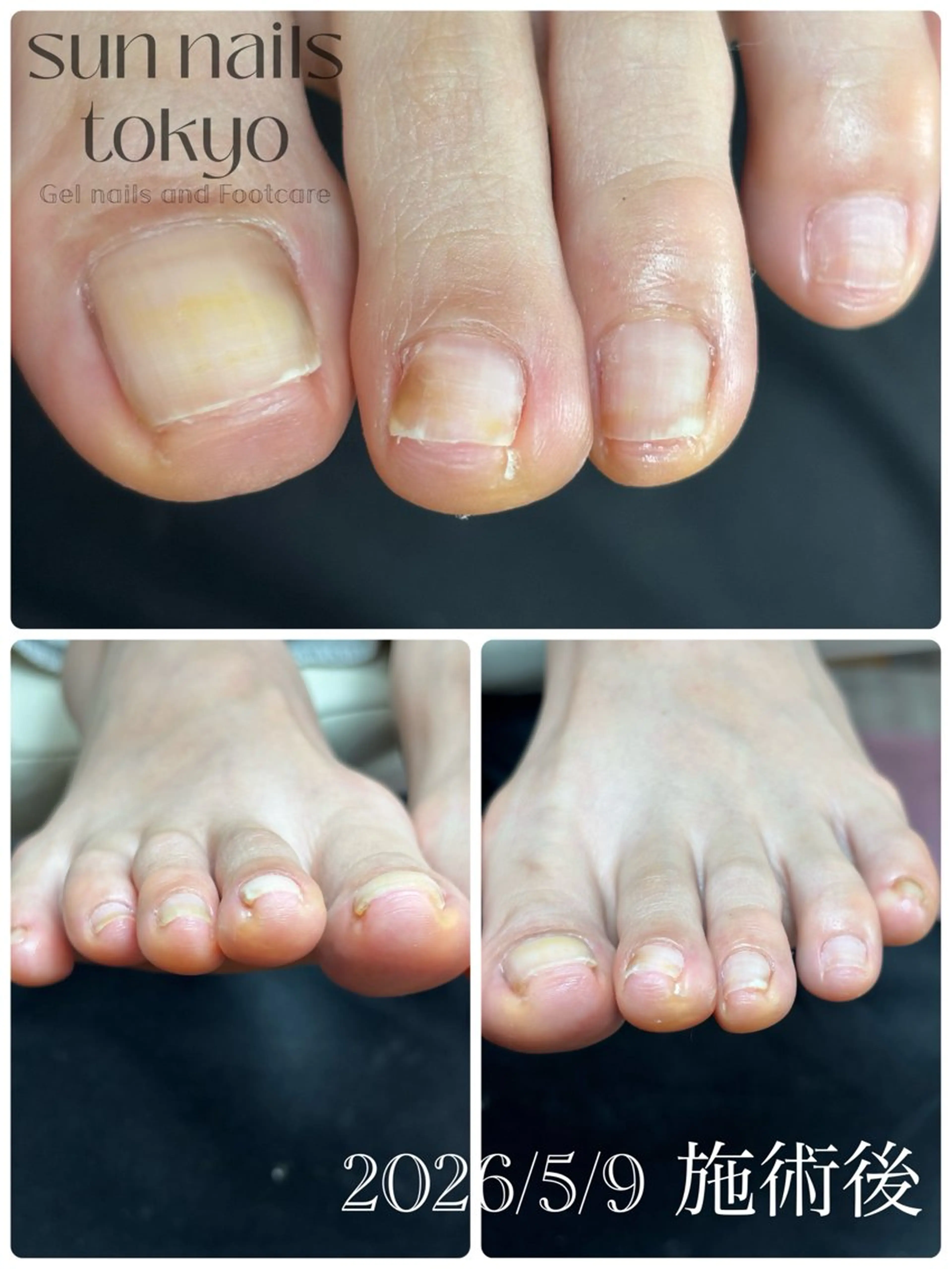 ネイル フットネイル Sun Nails Tokyo大網白里市のネイルデザイン