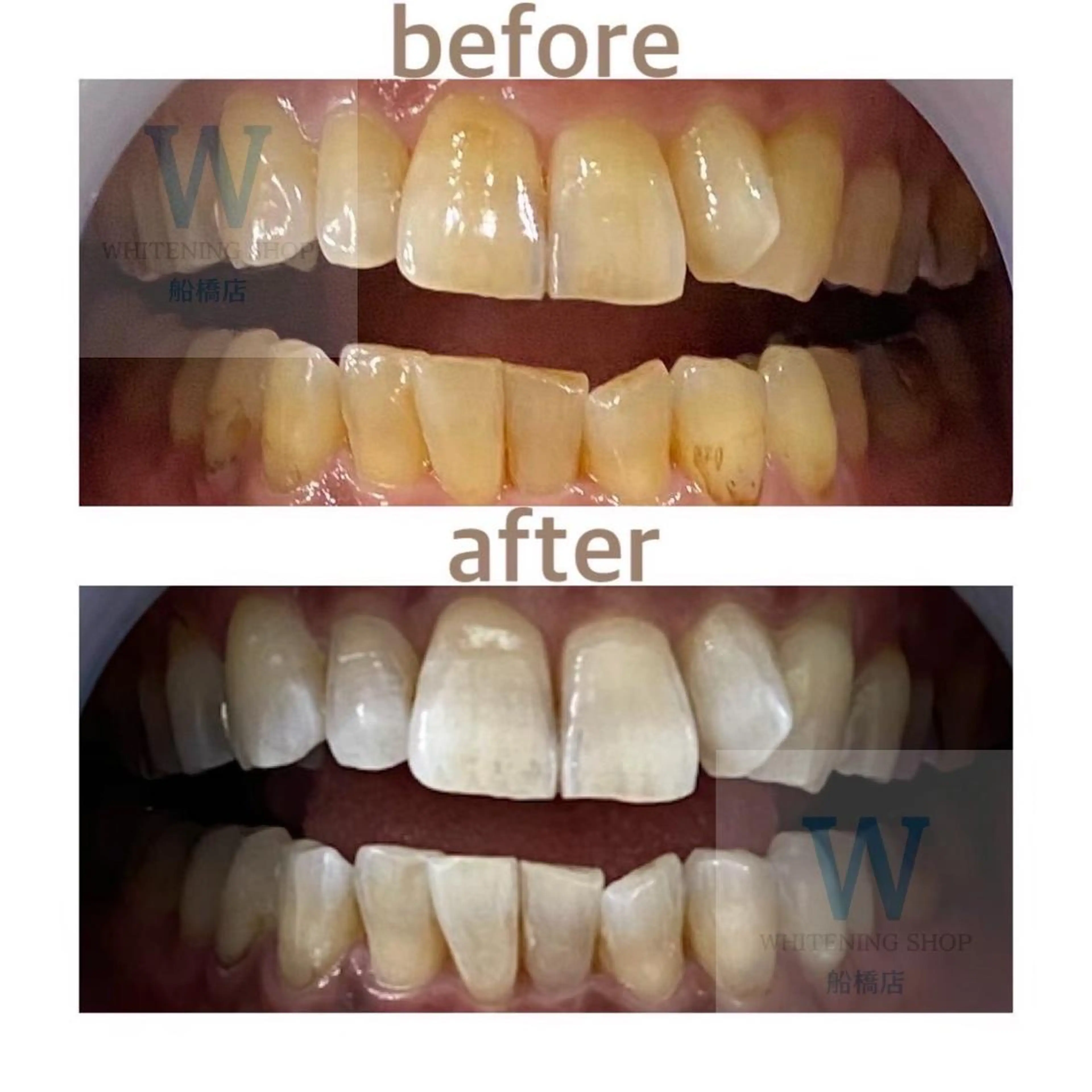 エステ リラク ホワイトニング ショップ船橋店🦷のエステ・リラクイメージ