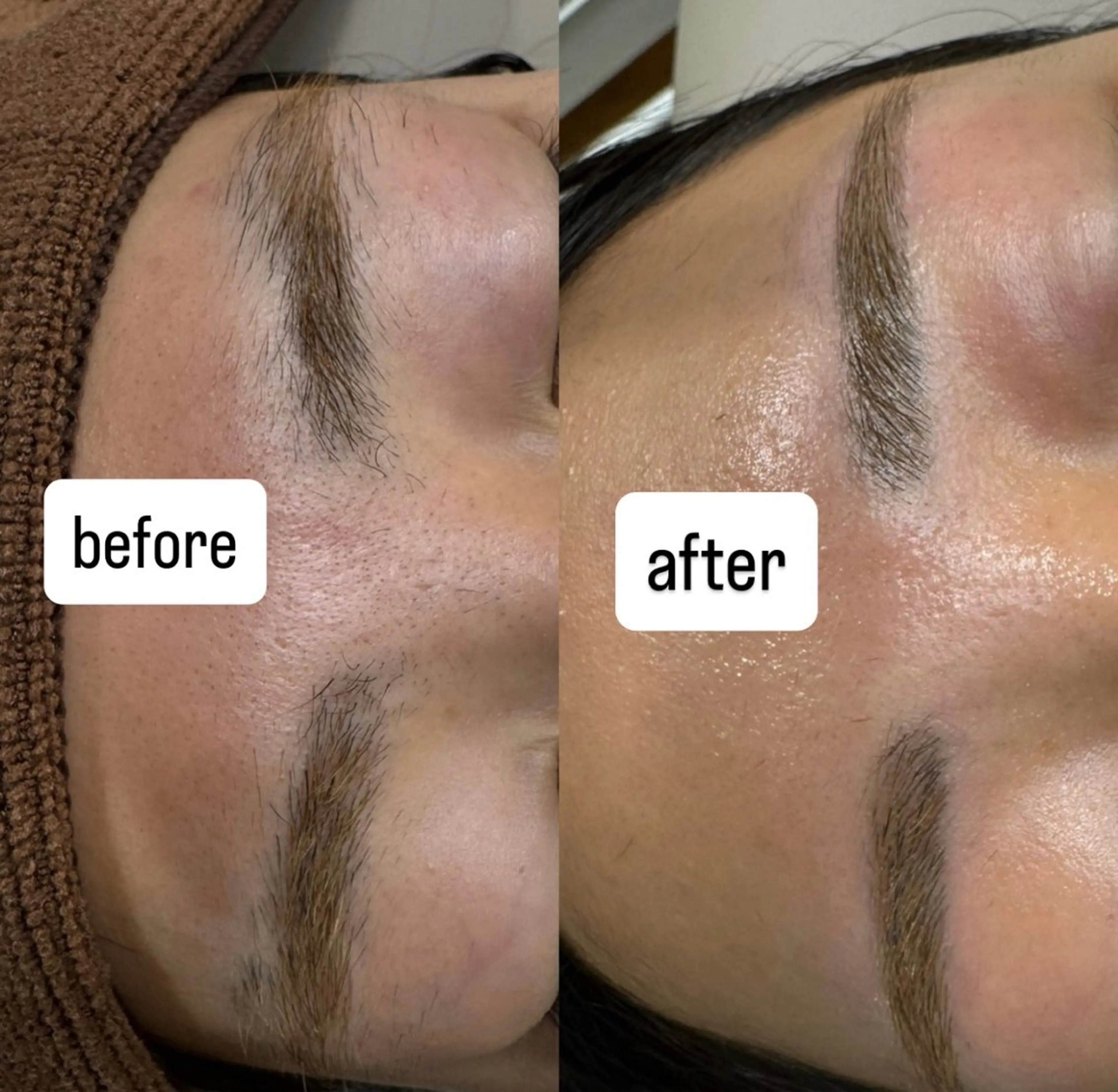 アイブロウ villa ☺︎草山 楓花のエステ・リラクイメージ