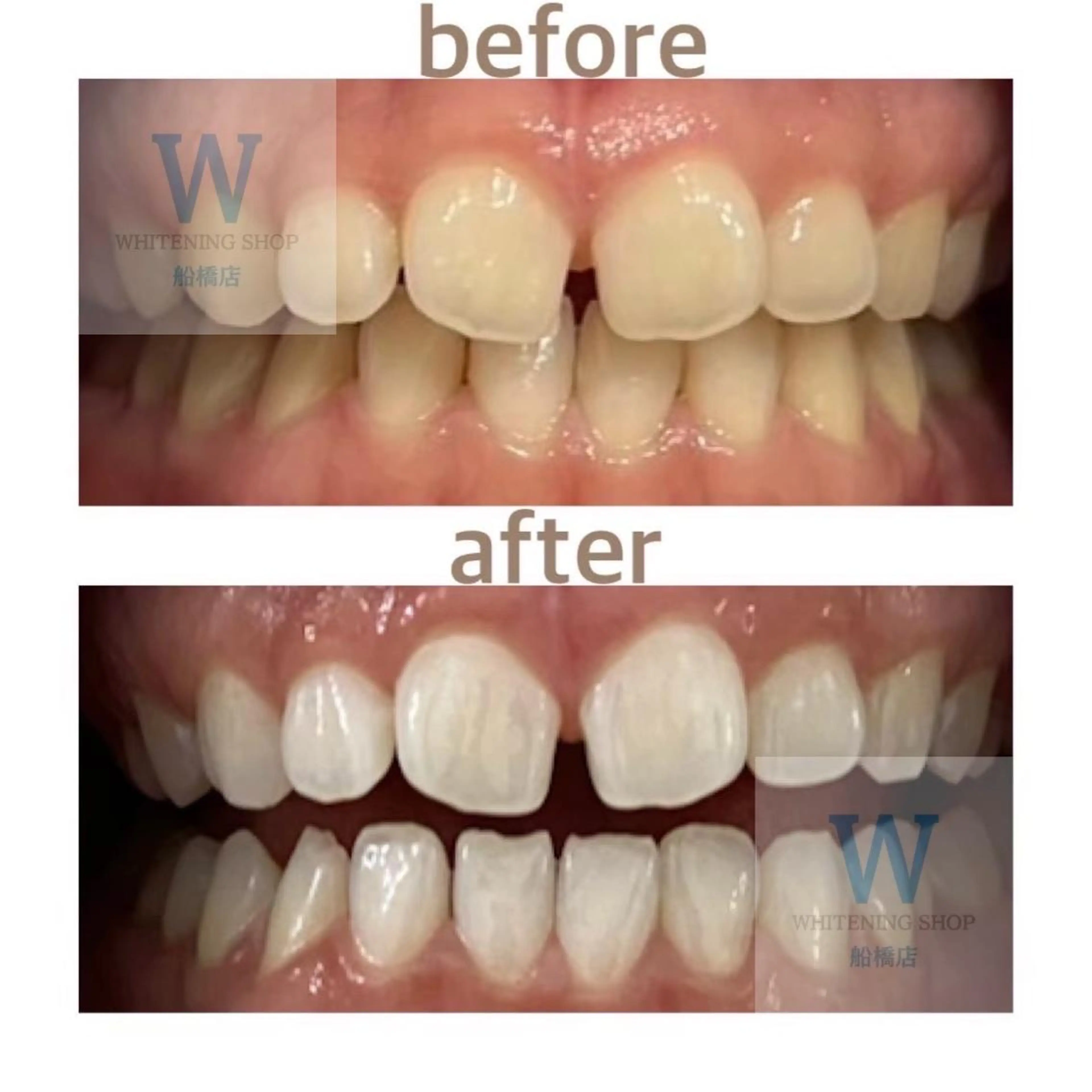 エステ リラク ホワイトニング ショップ船橋店🦷のエステ・リラクイメージ