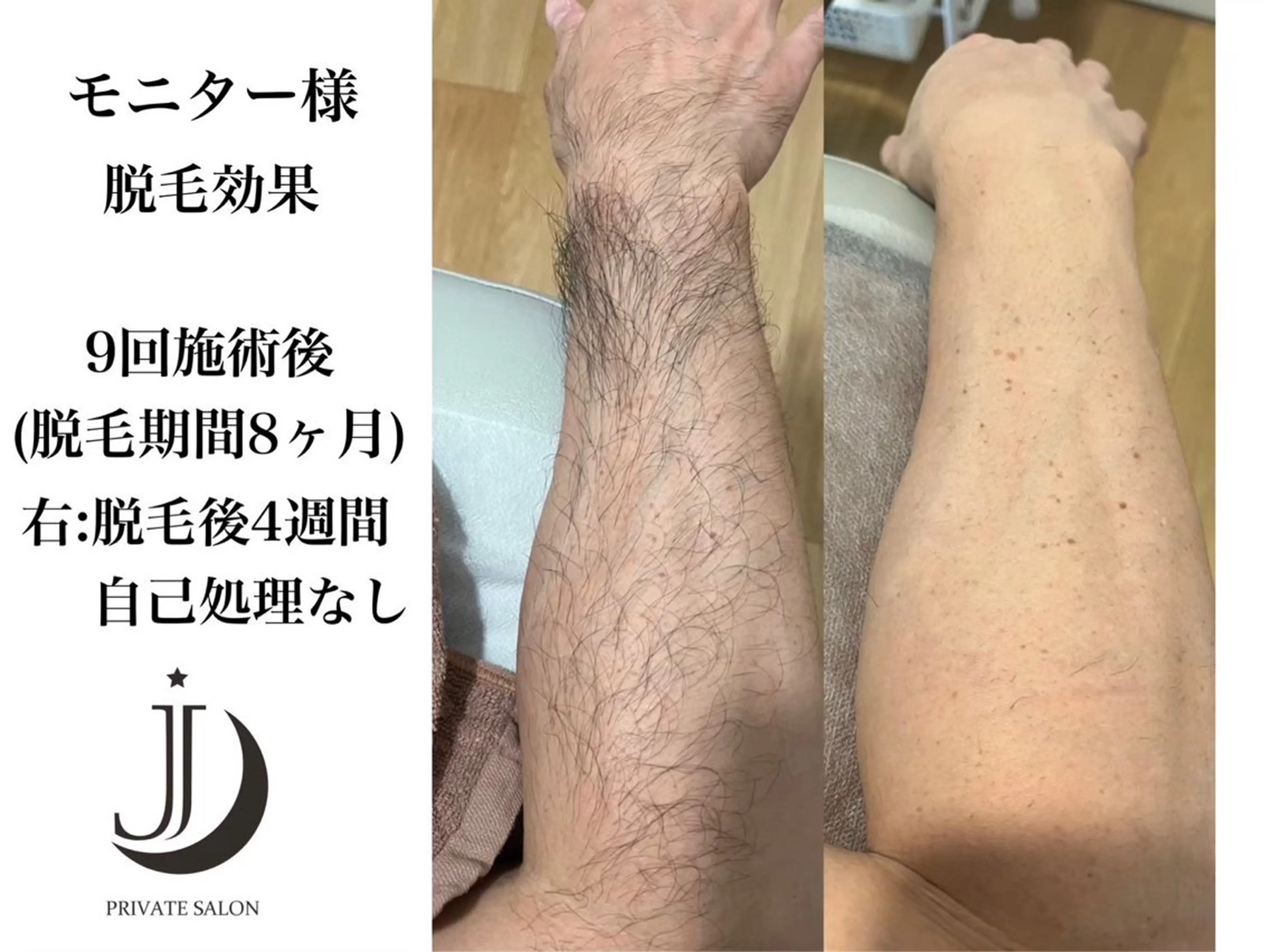 脱毛 private salon Jのエステ・リラクイメージ