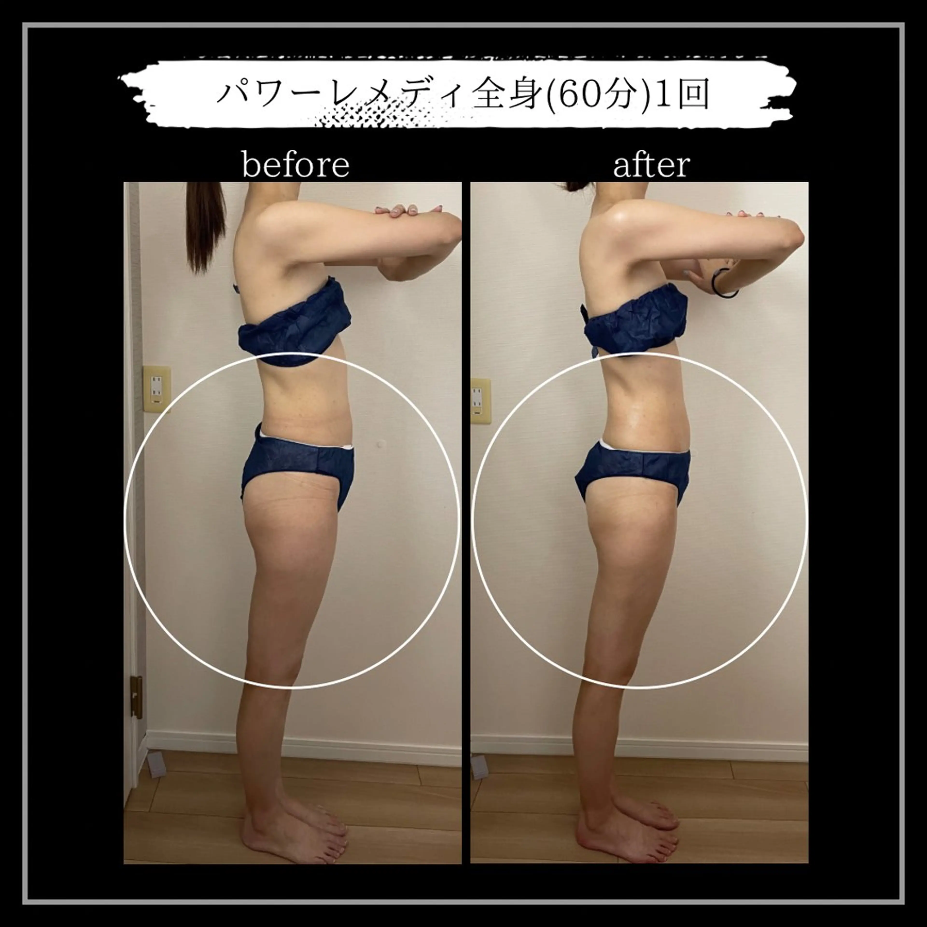 オフ:オン 全身筋膜マッサージのエステ・リラクイメージ