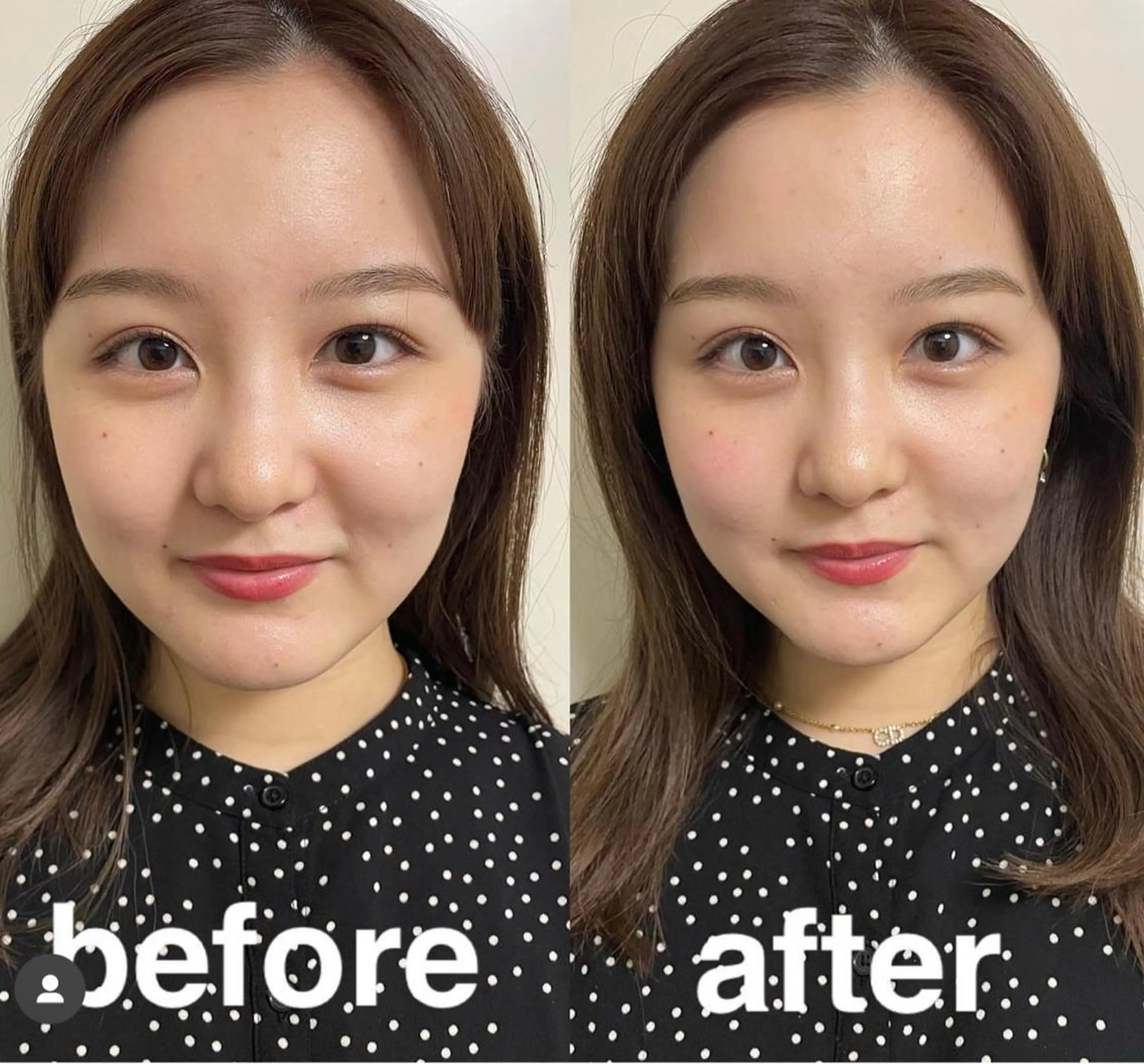 美容鍼灸サロン mahoroba院長のエステ・リラクイメージ