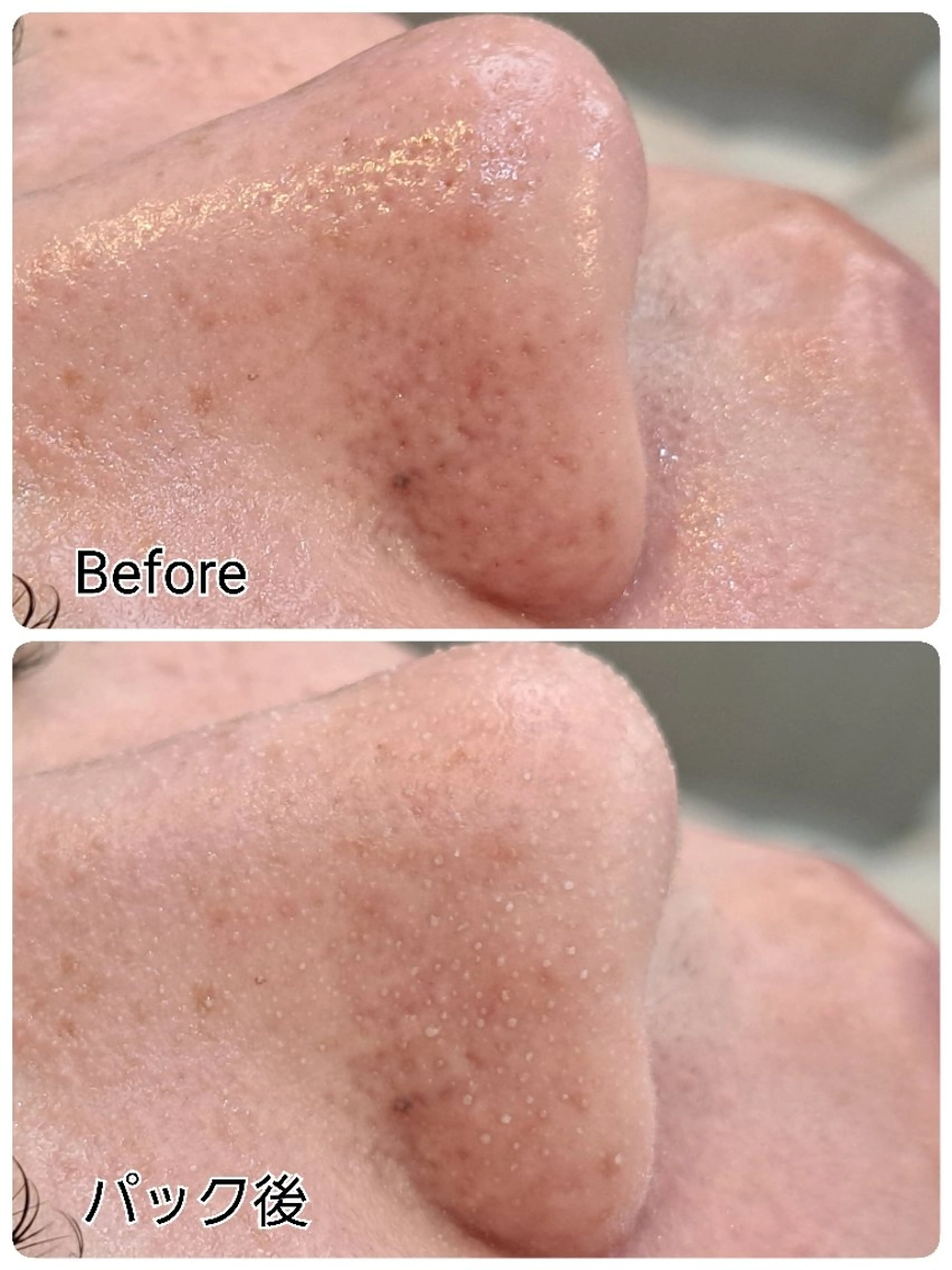 Hisui 種村のエステ・リラクイメージ