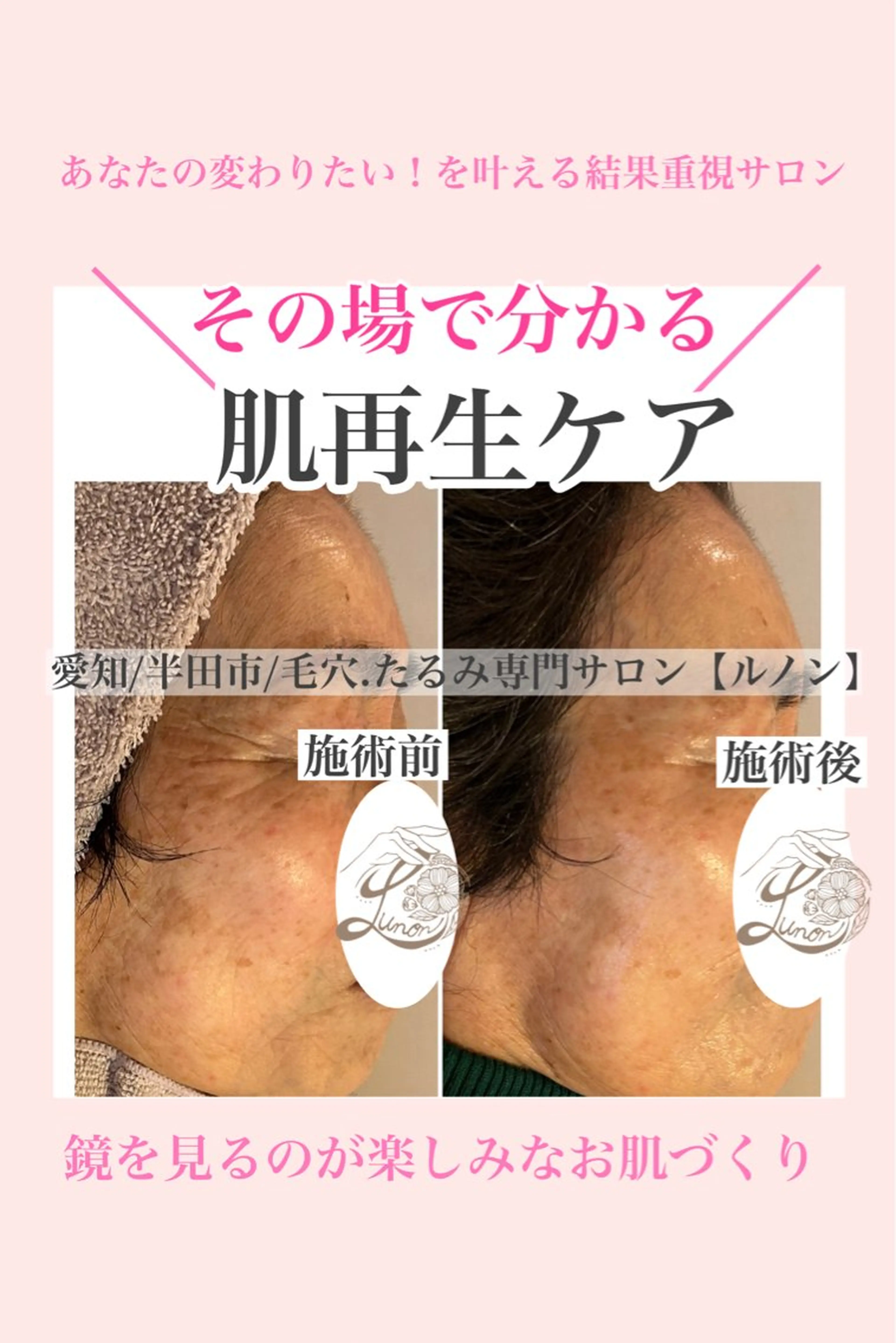 エステ 毛穴.たるみ専門店 Lunonのエステ・リラクイメージ