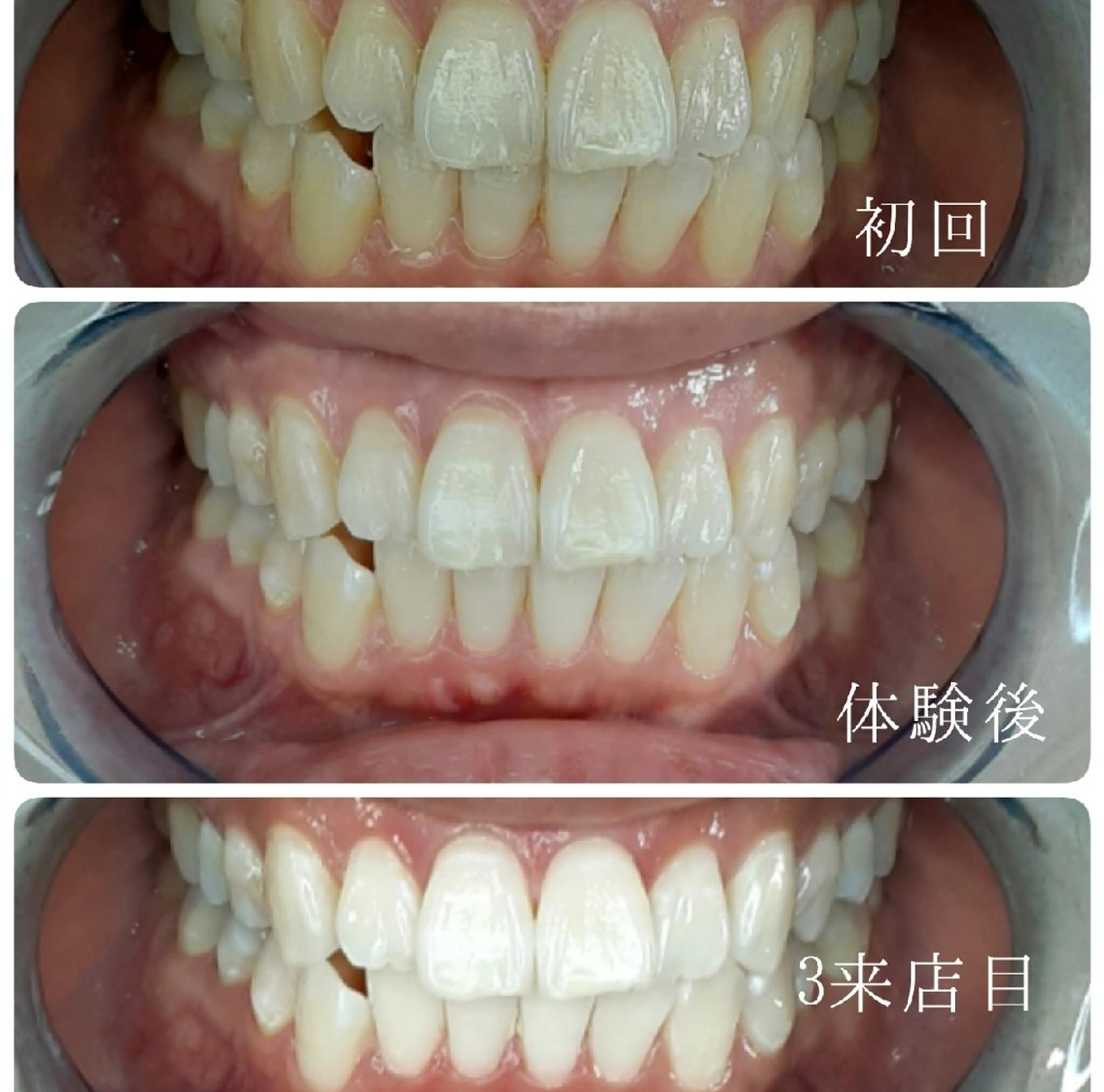 五十嵐 蓮のその他イメージ