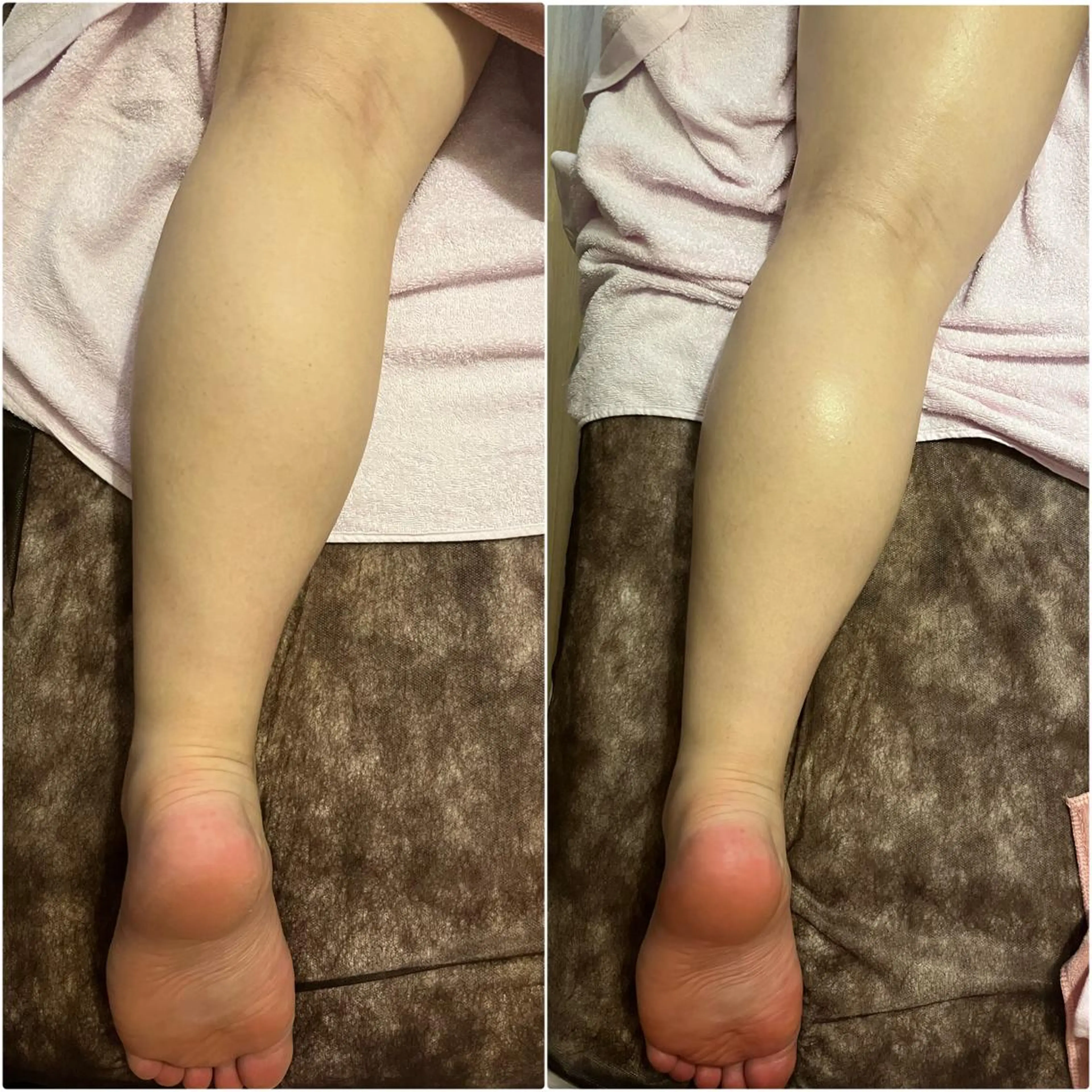 アロマ･美容鍼･カッ ピング「麗」鍼灸院のエステ・リラクイメージ