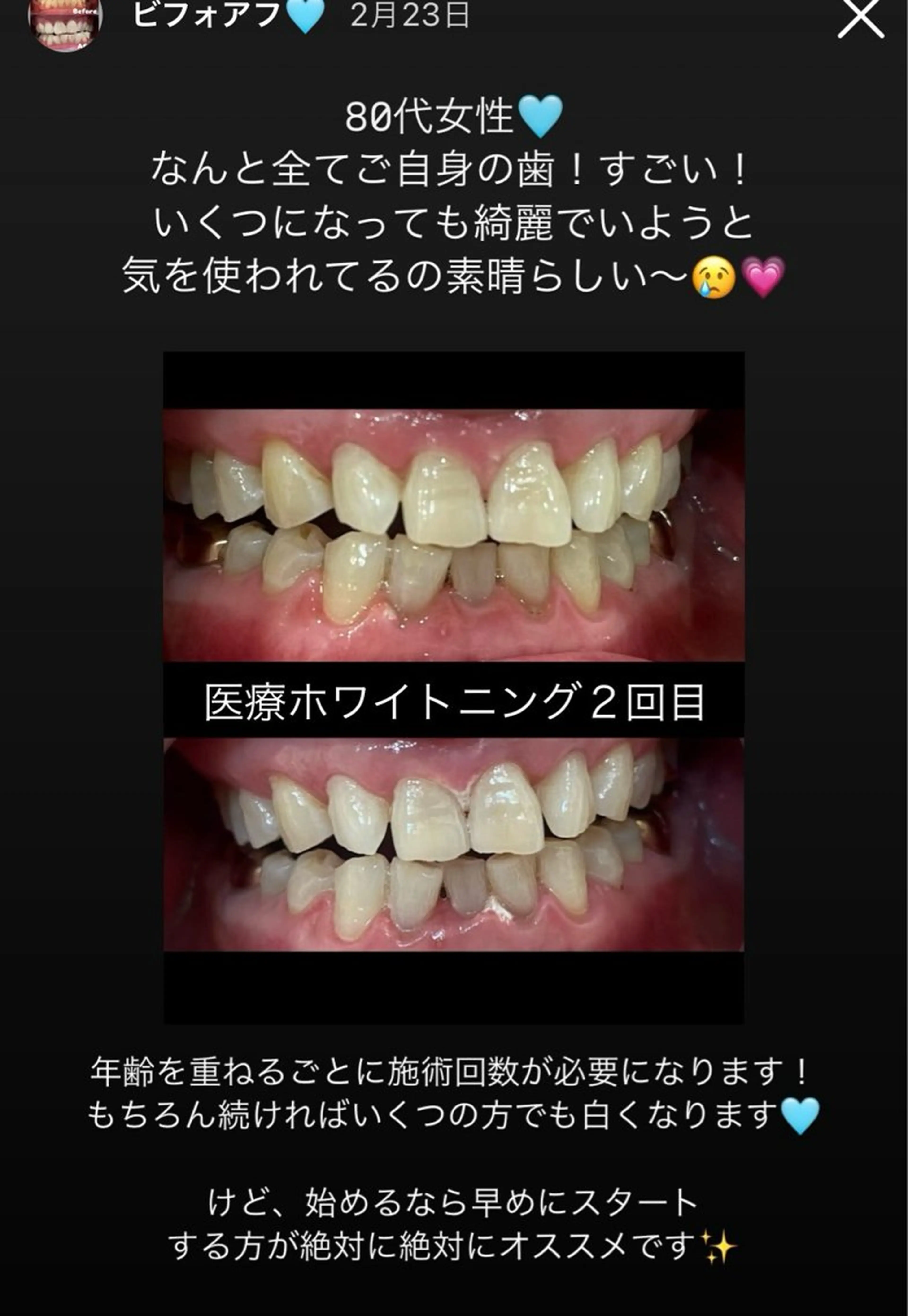 Kaula ホワイトニング🦷✨のエステ・リラクイメージ