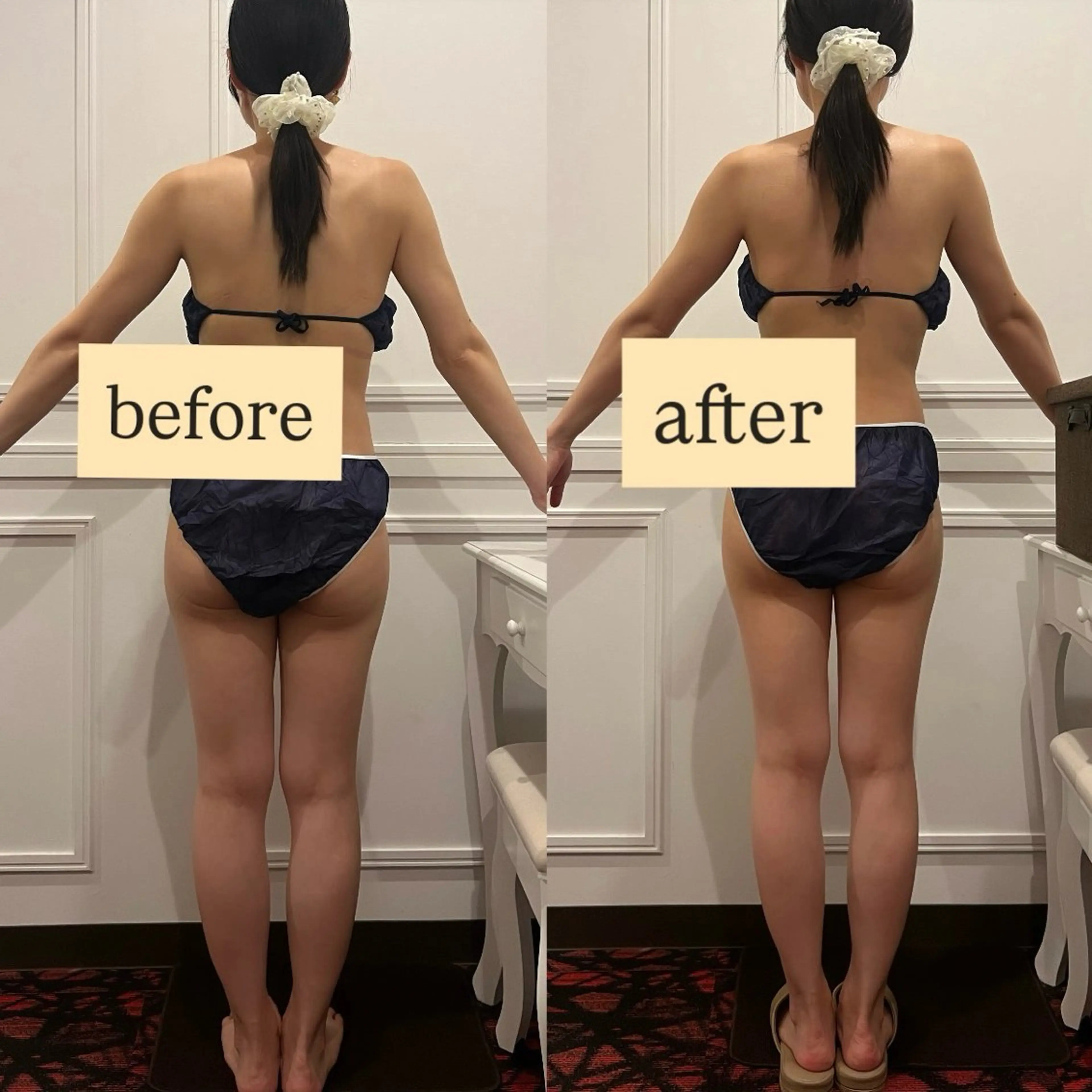 ー3月限定メニュー💭ྀིー【浮腫みやすいふくらはぎにアプローチ】ハイパーナイフEX！の写真