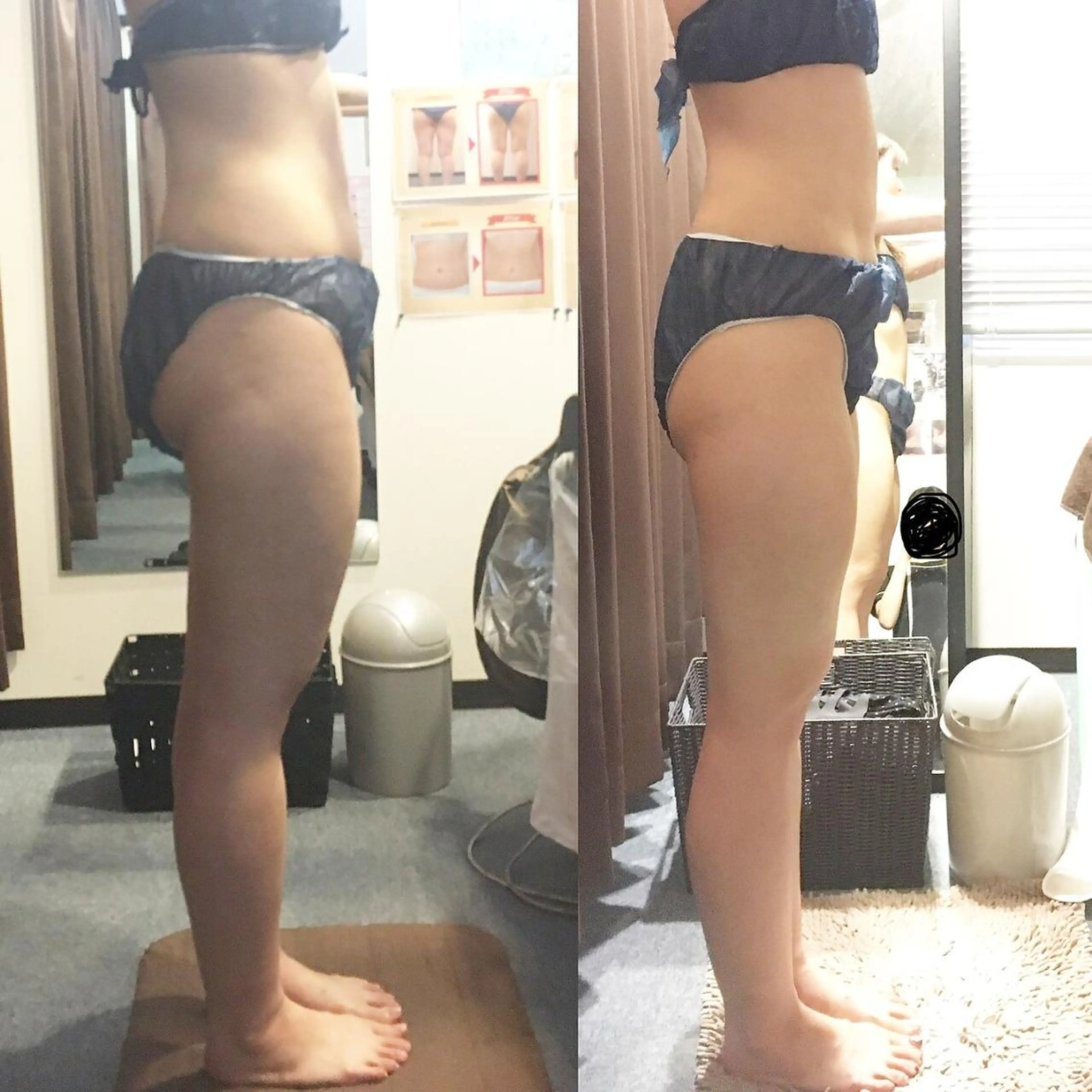 ✨人気No1✨短期集中💖ダイエット《2回プラン》!貴方だけのオーダーメイド痩身🤗7980円✨の写真