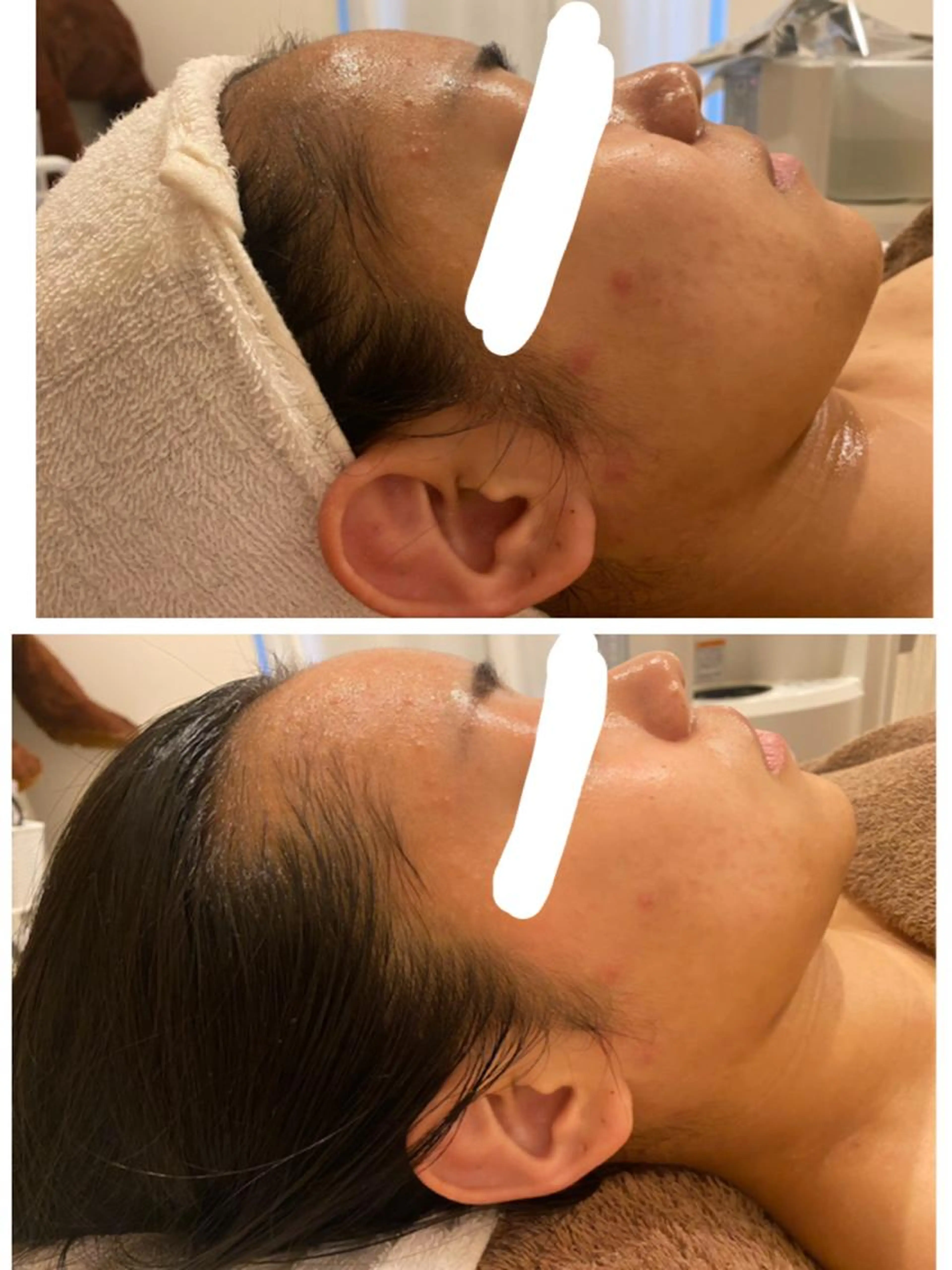 1番人気のエイジングケア🌿エイジング7700円→3300円の写真