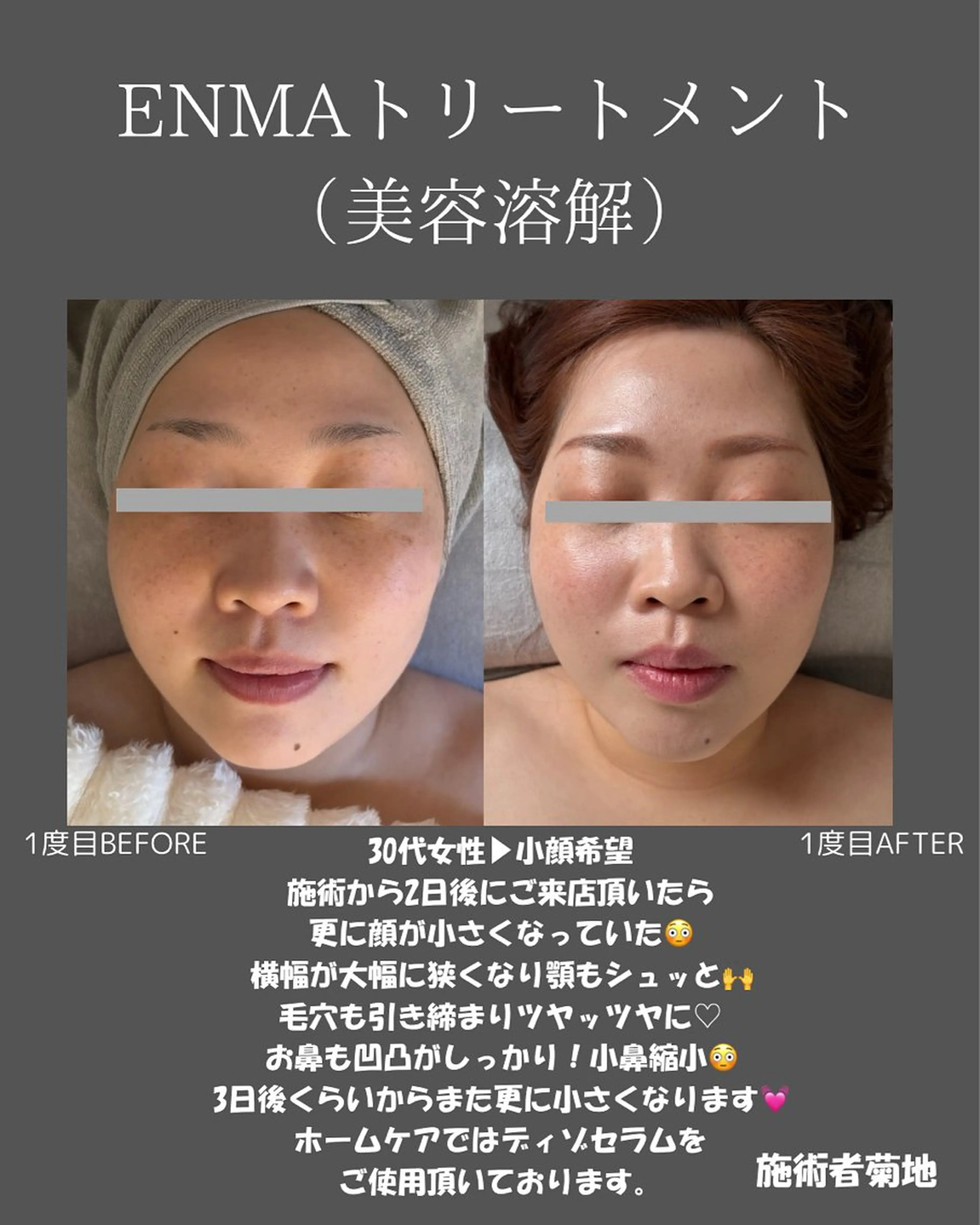 BLOSSOM 菊地のエステ・リラクイメージ