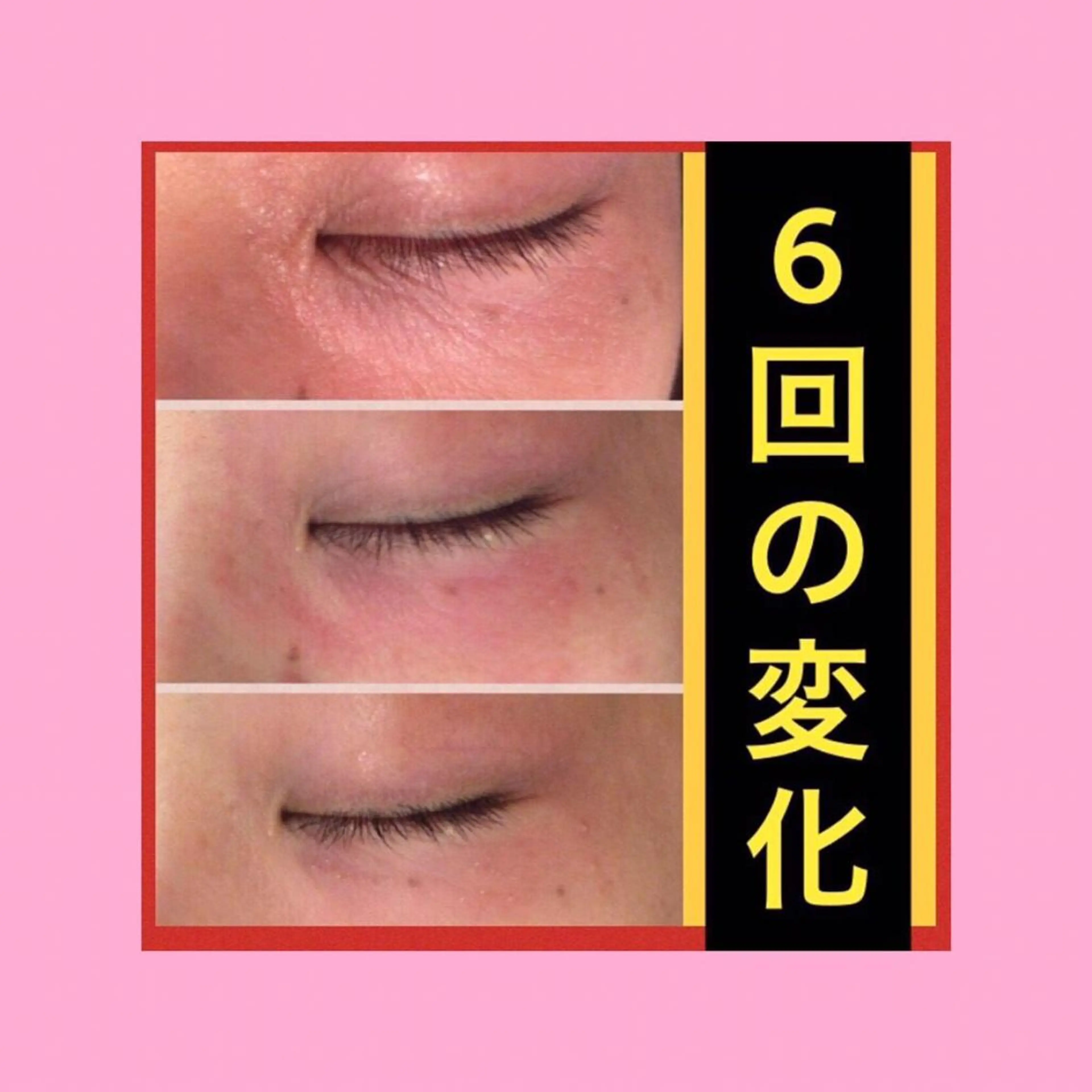 ミディアム カラー パーマ ヘアアレンジ メンズ キッズ ネイル マツエク・マツパ ニキビ・肌質改善専門 ♡人生が変わるサロンのエステ・リラクイメージ