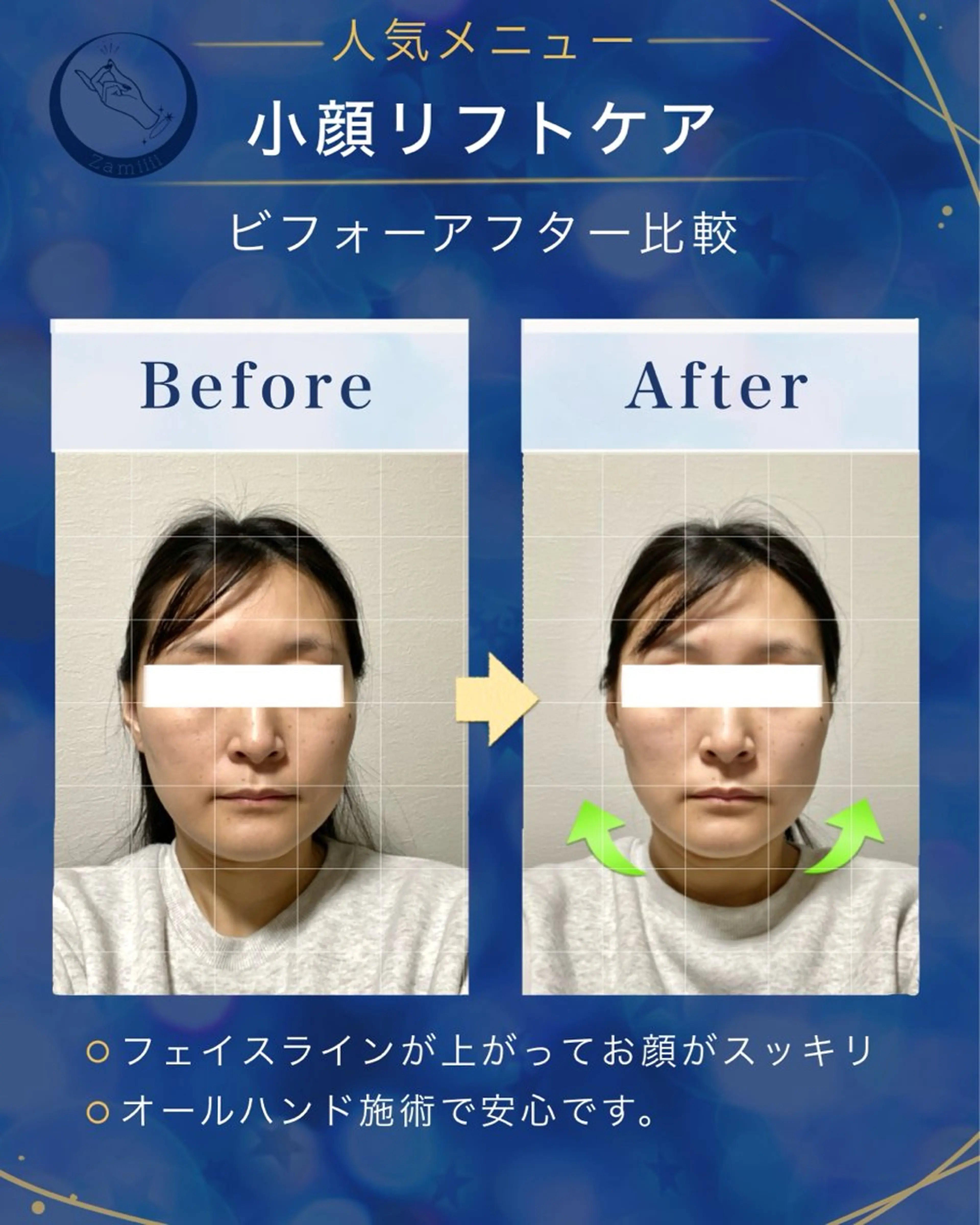 小顔リフトケアの写真