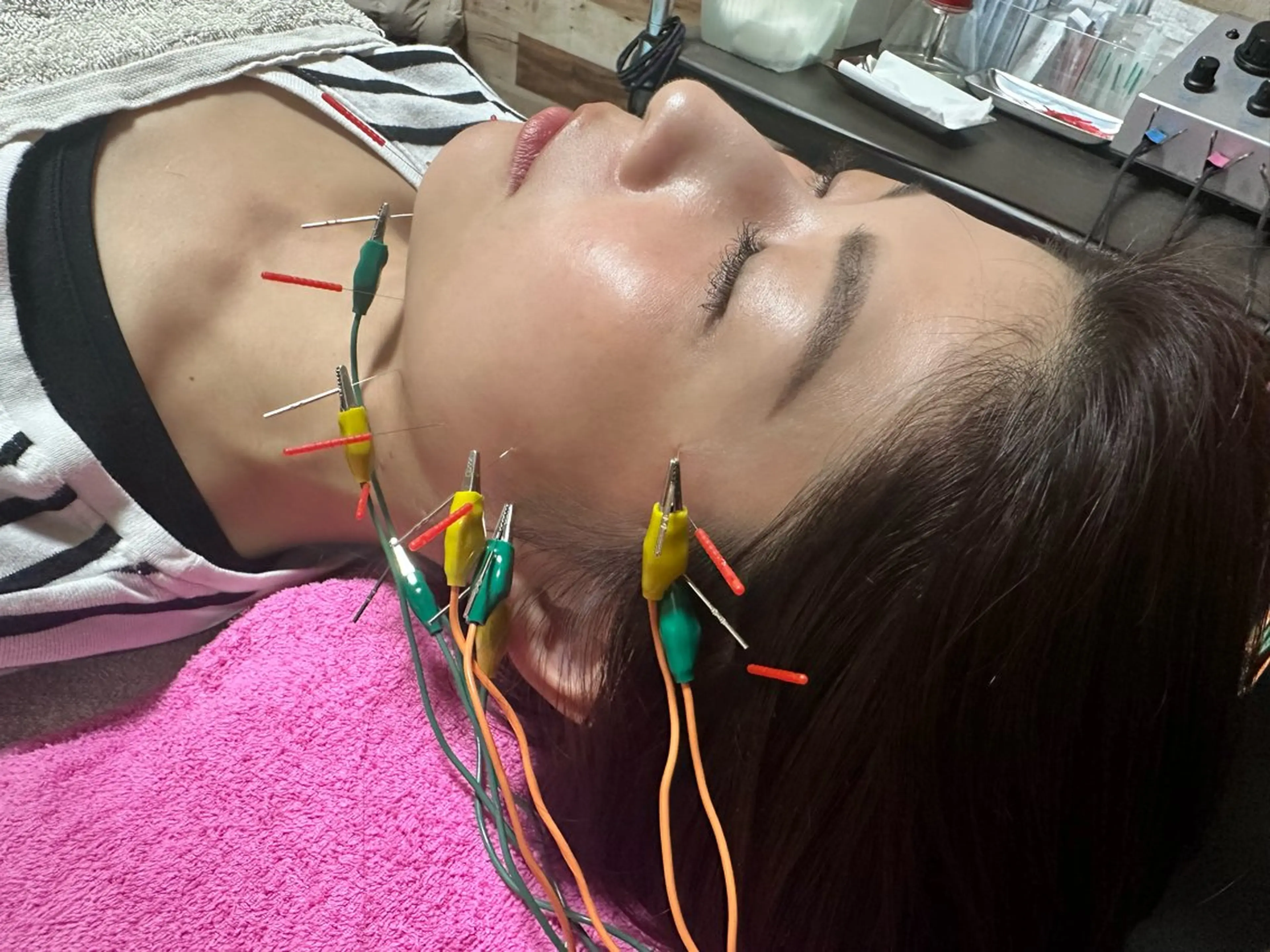 エステ リラク はりすたいる 鍼灸院のエステ・リラクイメージ