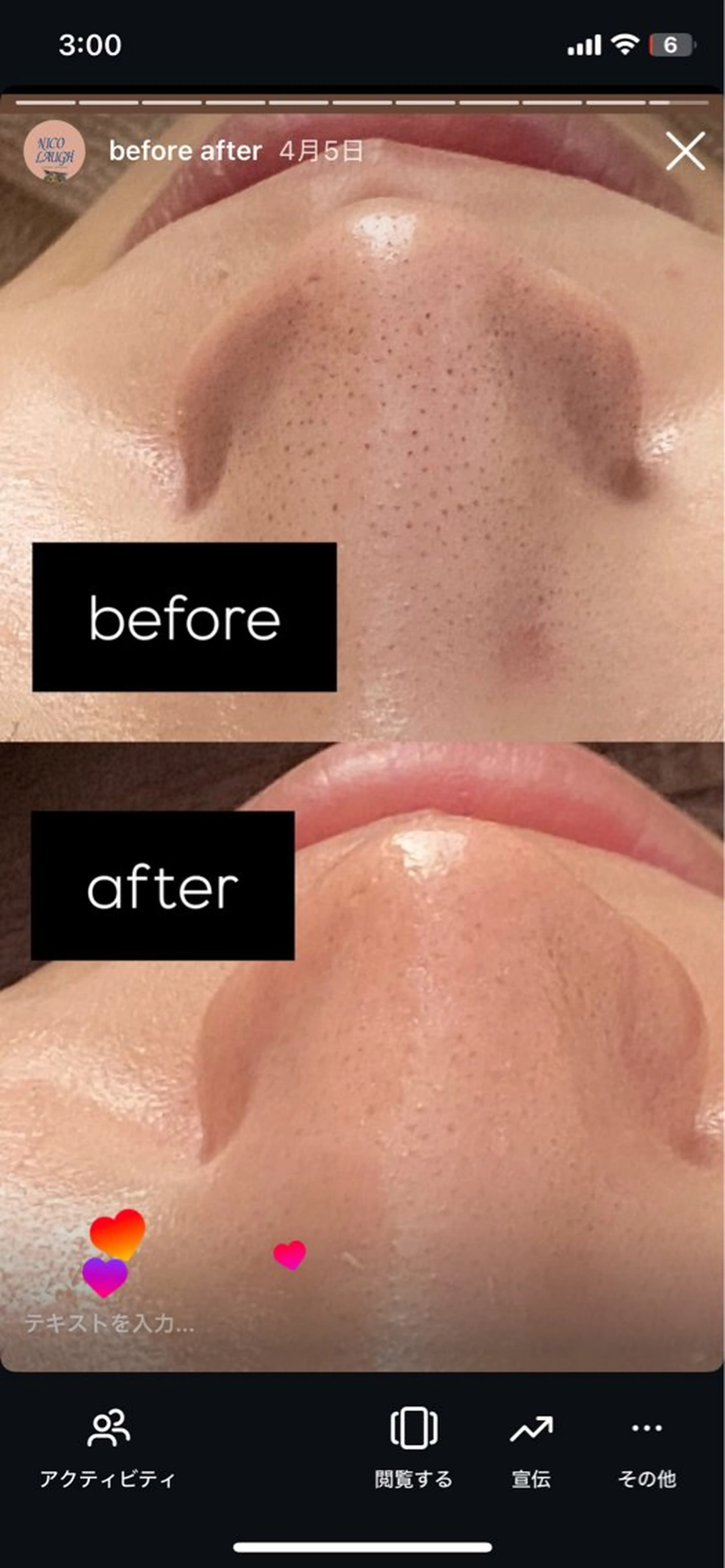 【肌質改善・腸揉み】 Nico laughのエステ・リラクイメージ