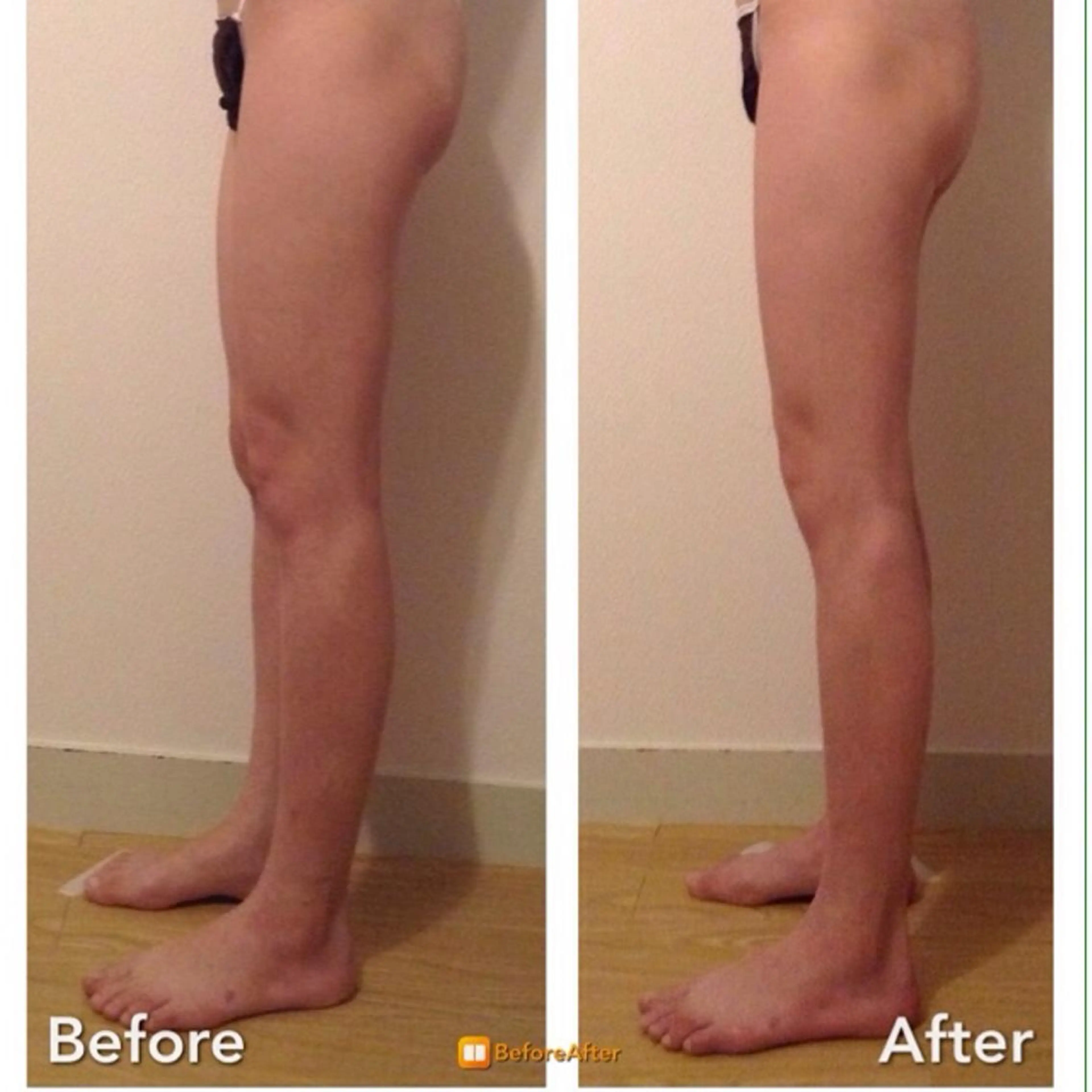 小尻・太もも痩せる エステルナボーテのエステ・リラクイメージ