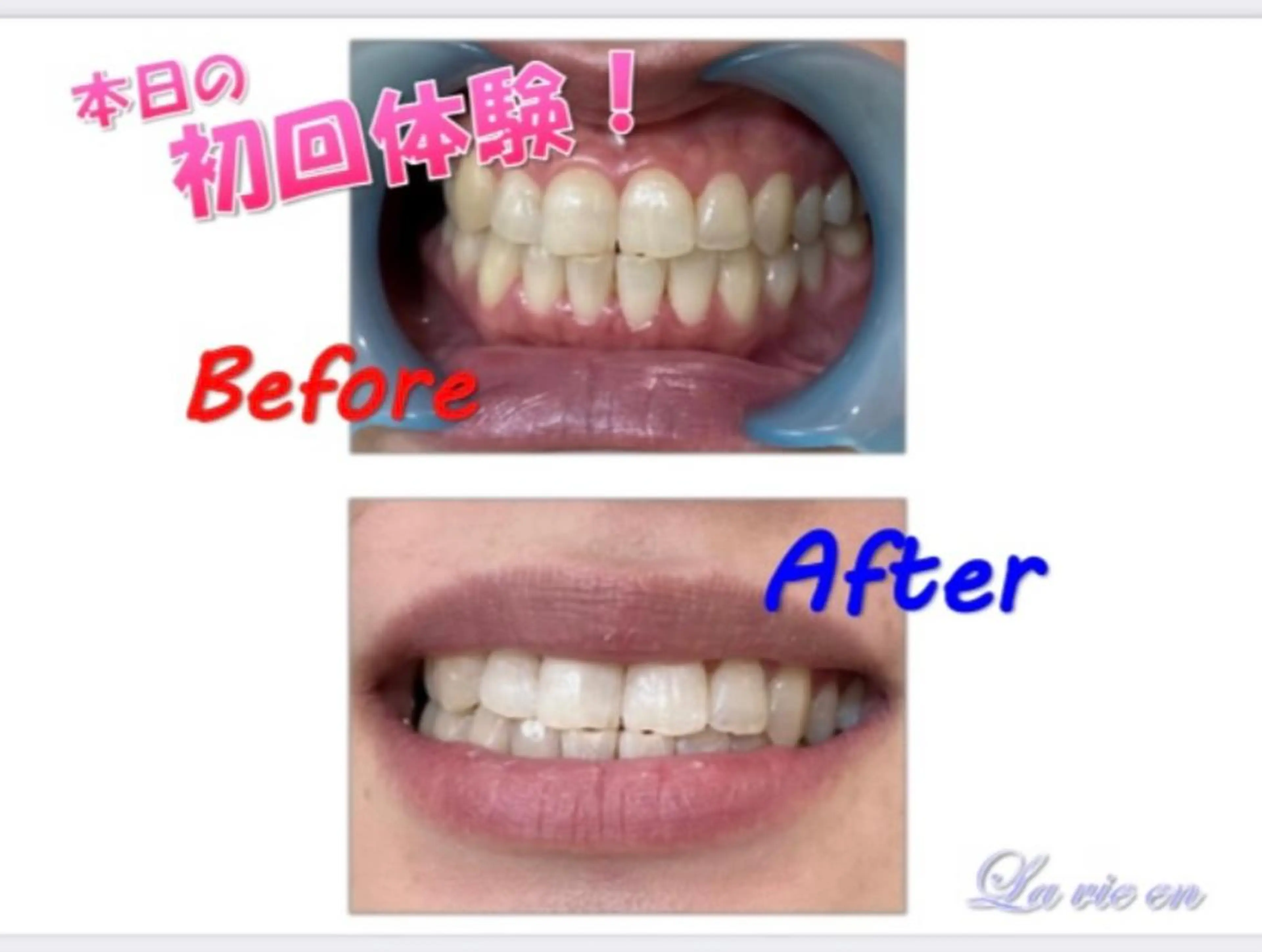 その他 ホワイトニングサロン La vie enのその他イメージ